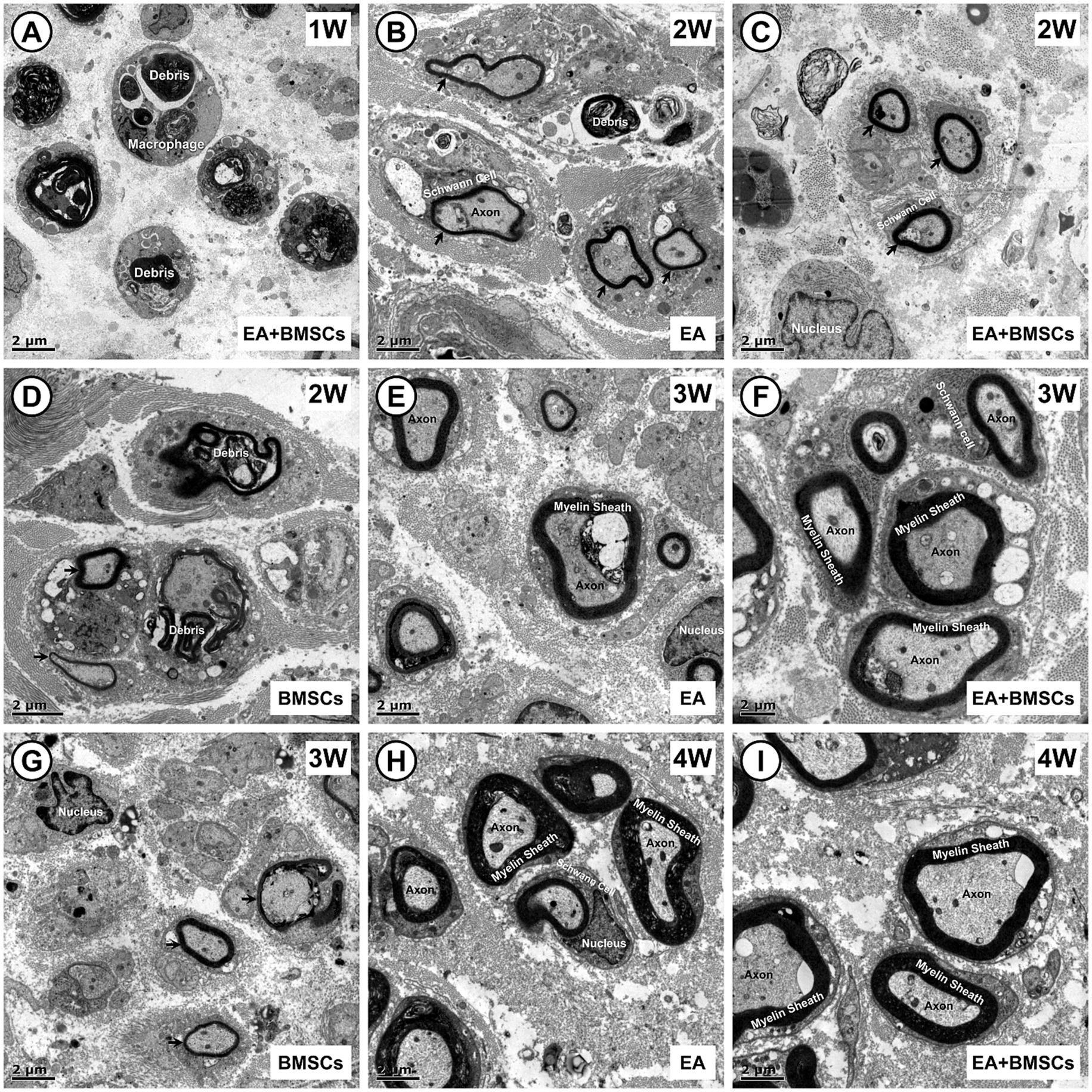 Microscopic images in a 3x3 grid showing nerve regeneration over time with different treatments. Sections labeled