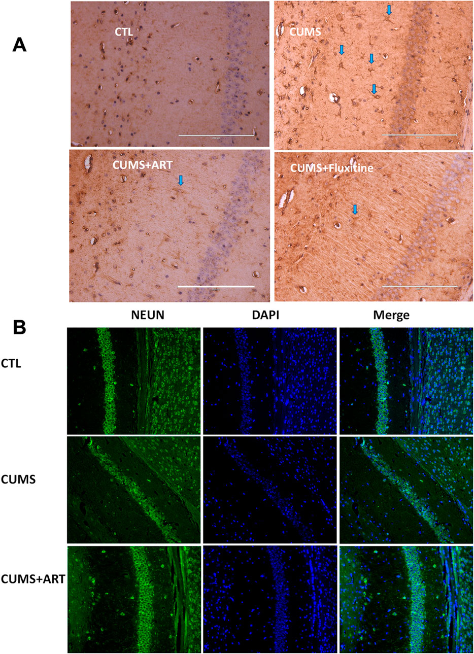 The image consists of two panels, A and B. Panel A shows four histological sections of brain tissue: CTL, CUMS, CUMS+ART, and CUMS+Fluoxetine, with blue arrows indicating specific features. Panel B presents immunofluorescence images of brain sections labeled with NEUN and DAPI, illustrating the control (CTL), CUMS, and CUMS+ART conditions, highlighting differences in neuronal and nuclear staining.