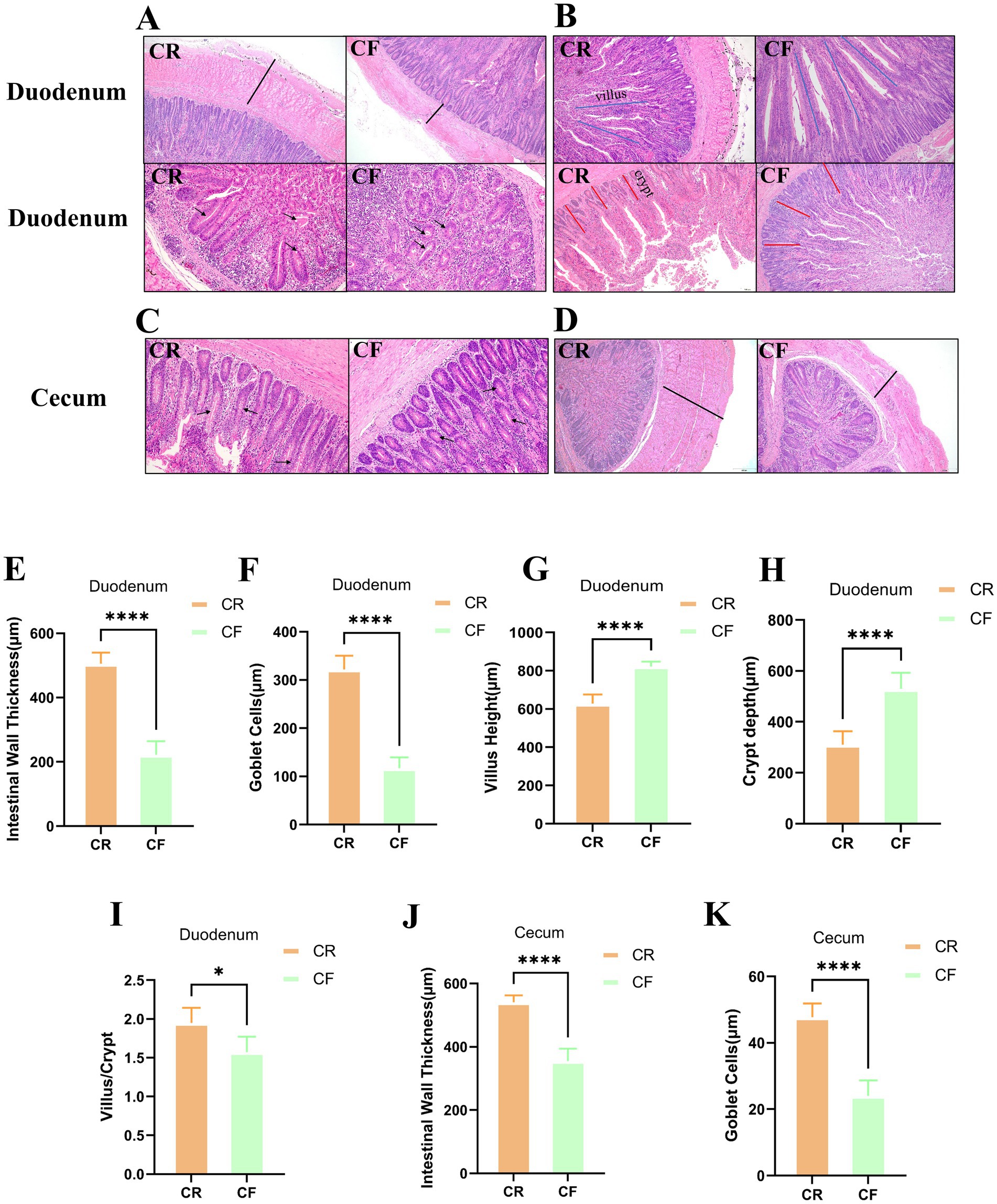 Histological images and bar graphs comparing intestinal structures and measurements in CR and CF samples. Panels A-D show micrographs of the duodenum and cecum. Panels E-K display bar graphs of intestinal wall thickness, goblet cells, villus height, crypt depth, and villus-to-crypt ratios, indicating significant differences between CR (orange) and CF (green) groups, with statistical notations marked.