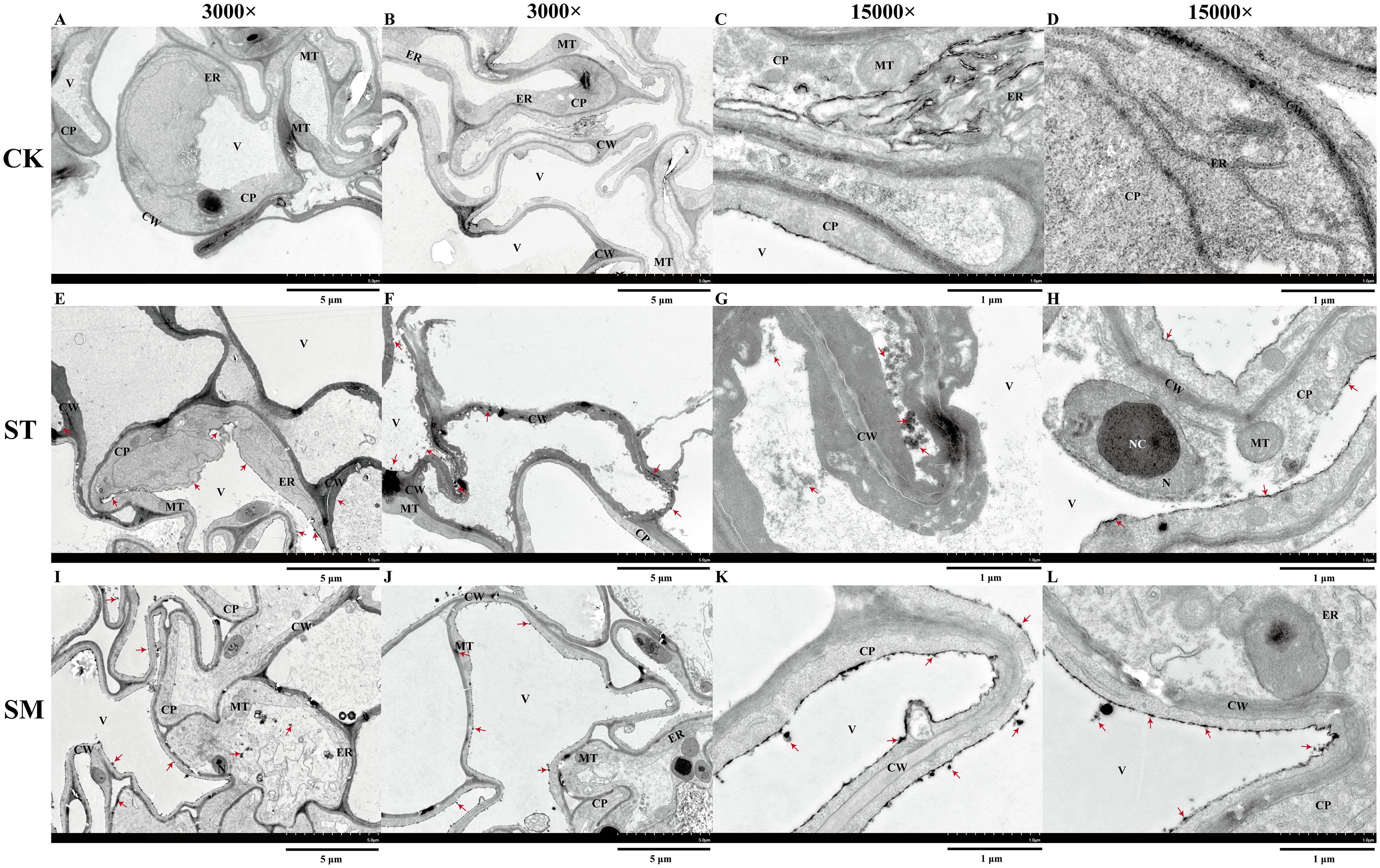 Transmission electron microscopy images of cell structures at different magnifications (3000x and 15000x). Panels A to D (CK), E to H (ST), and I to L (SM) show various cellular components such as vacuoles (V), endoplasmic reticulum (ER), mitochondrial structures (MT), cytoplasmic inclusions (CP), cell walls (CW), nucleoli (NC), and nuclei (N). Red arrows indicate specific features or points of interest in the micrographs. Scale bars indicate sizes ranging from 5 micrometers to 1 micrometer.