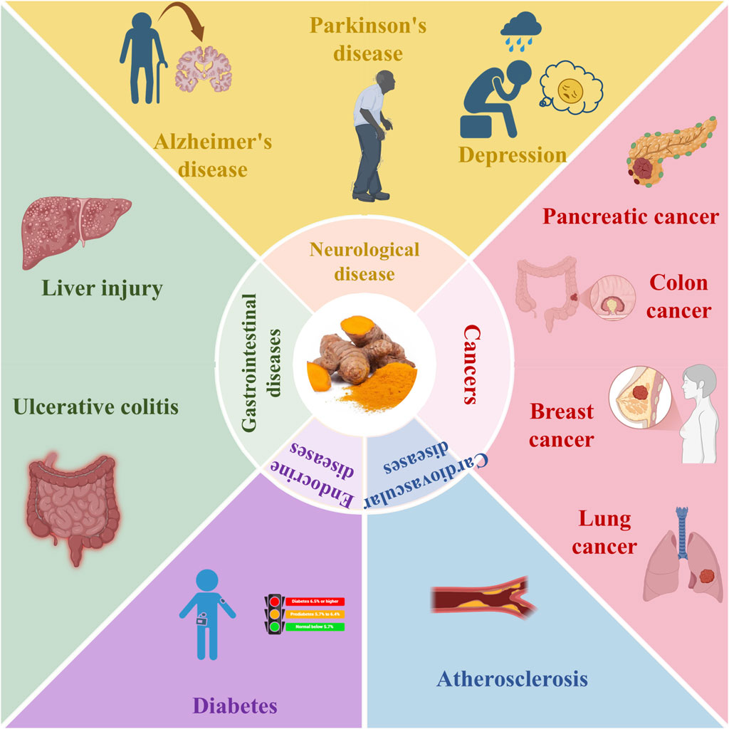 Diagram illustrating diseases categorized into four sections around a central image of turmeric. Sections include Neurological diseases (Alzheimer's, Parkinson's, Depression), Cancers (Pancreatic, Colon, Breast, Lung), Cardiovascular diseases (Atherosclerosis), Endocrine diseases (Diabetes), and Gastrointestinal diseases (Liver injury, Ulcerative colitis).