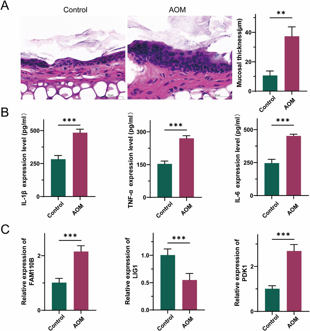 Section A shows histological images comparing mucosal thickness between Control and AOM, with AOM displaying increased thickness. Section B presents bar graphs indicating elevated expression levels of IL-1β, TNF-α, and IL-6 in AOM compared to Control. Section C shows bar graphs of gene expression, revealing higher levels of FAM110B and PDK1 and lower levels of LIG1 in AOM versus Control. Statistical significance is indicated with asterisks.