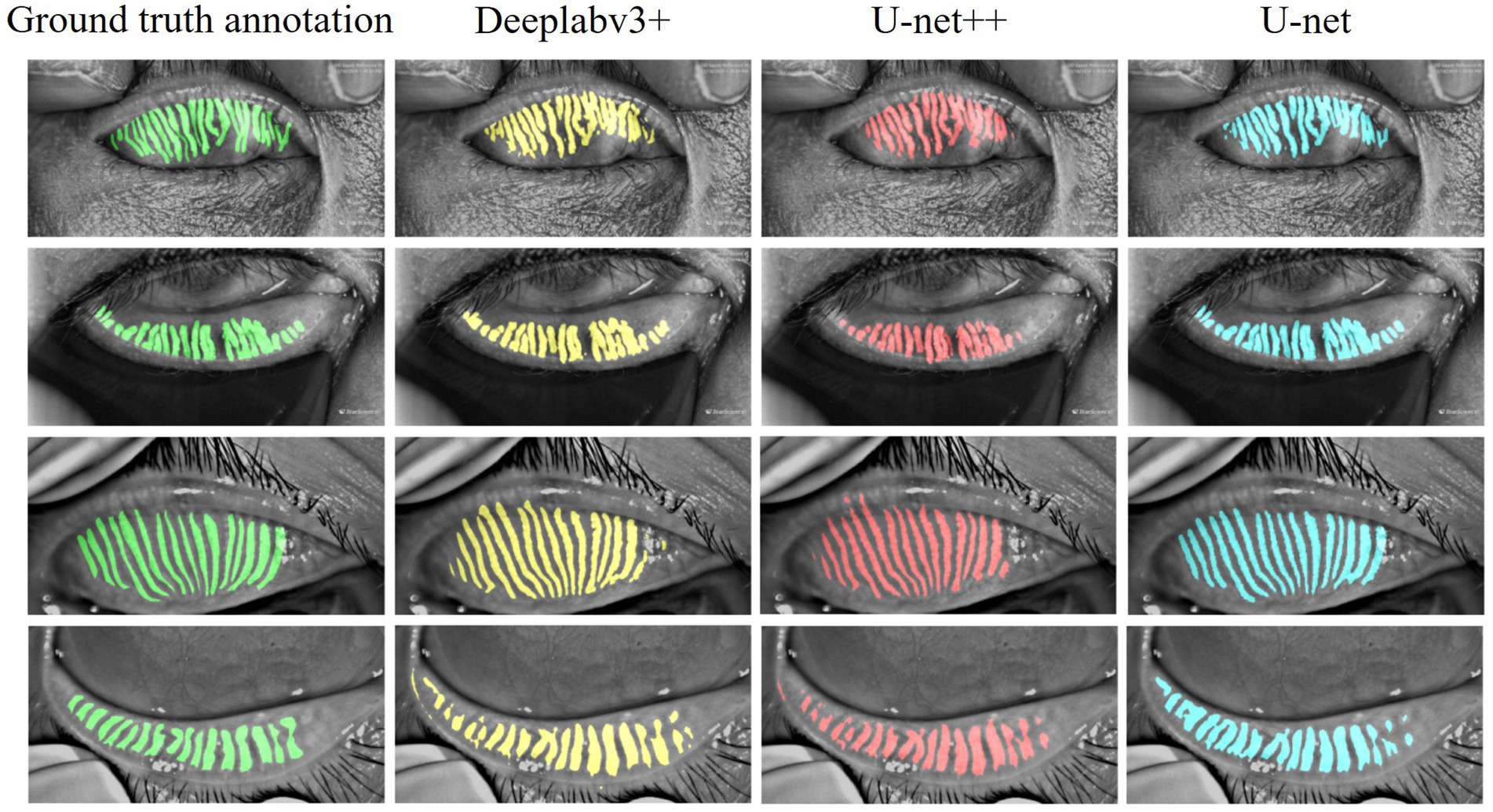 Grayscale images of human eyes show segmented areas using color overlays. Each row presents the same eye under four different conditions: ground truth annotation in green, Deeplabv3+ in yellow, U-net++ in red, and U-net in blue. The images display comparisons of segmentation methods for visualizing anatomical features.