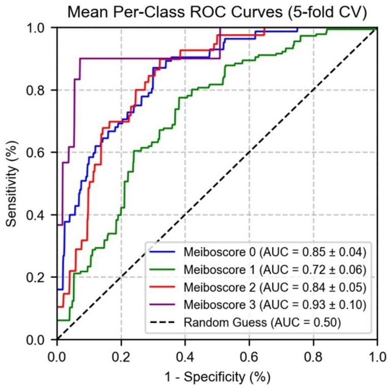 Receiver Operating Characteristic (ROC) curves for different Meiboscores, showing the sensitivity versus one minus specificity. Meiboscore 0, 1, 2, and 3 are represented by blue, green, red, and purple lines respectively. A dashed black line indicates random guessing. Area Under the Curve (AUC) values are 0.85 for Meiboscore 0, 0.72 for Meiboscore 1, 0.84 for Meiboscore 2, 0.93 for Meiboscore 3, and 0.50 for random guessing. The chart exemplifies mean per-class ROC using five-fold cross-validation.