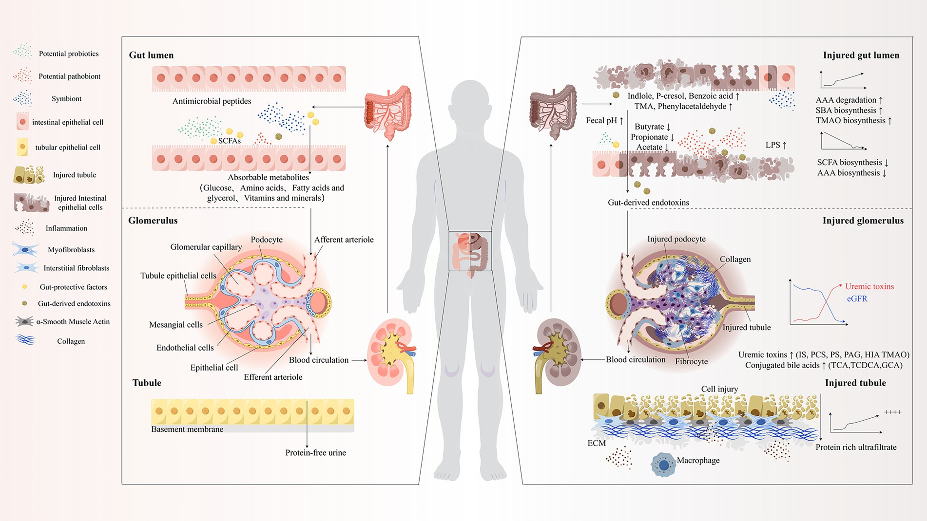 Diagram illustrating the interaction between the gut and kidneys. The gut lumen shows probiotics, pathobionts, and SCFAs within intestinal epithelial cells. The glomerulus displays podocytes, capillaries, and tubule epithelial cells. Injured gut and kidney sections highlight endotoxins, microbial metabolites, and cell injury processes. Graphs indicate changes in AAA degradation, uremic toxins, and eGFR levels.