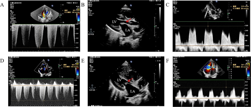 Medical illustrations of echocardiographic images labeled \