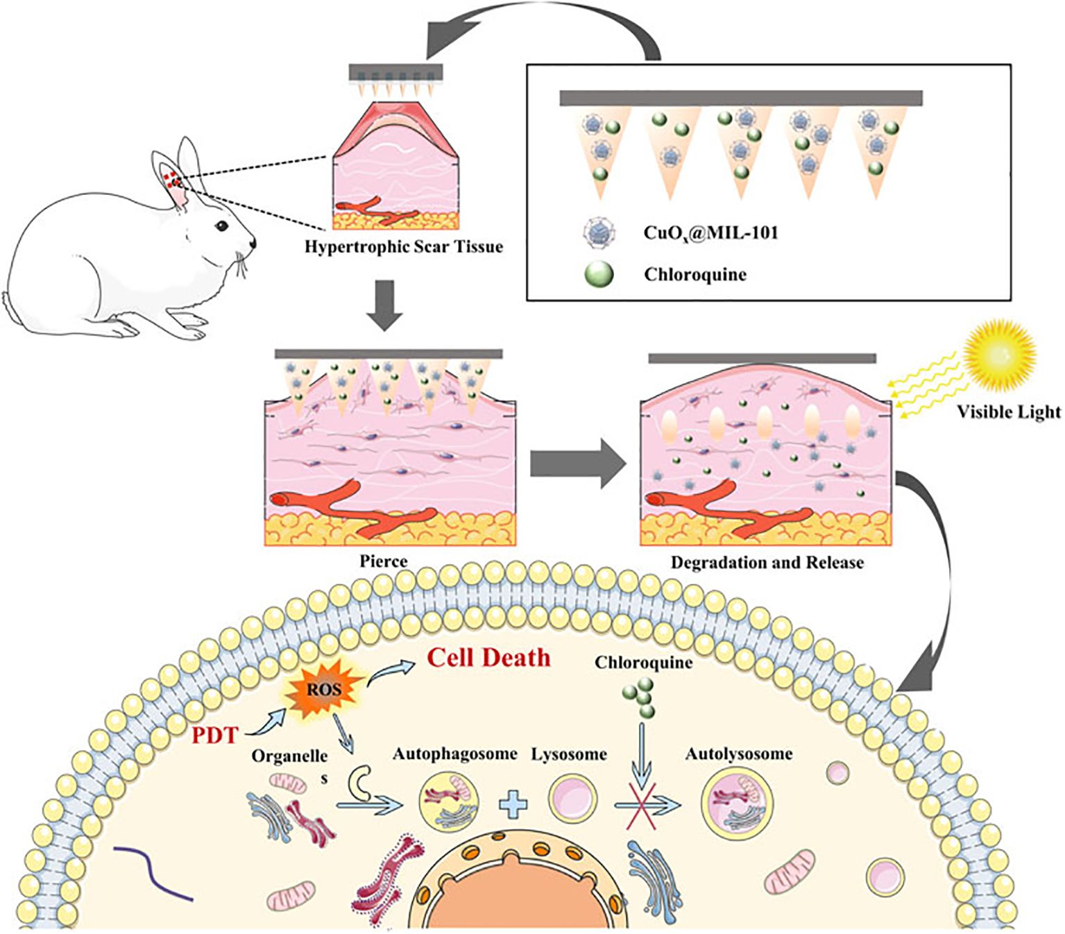 Diagram illustrating a rabbit with hypertrophic scar tissue treated using CuO\(_2\)@MIL-101 and chloroquine. The treatment involves visible light-induced penetration, degradation, and release of substances, leading to cell death through processes involving ROS and PDT. The cellular sequence shows interaction with organelles, autophagosome, lysosome, and autolysosome.
