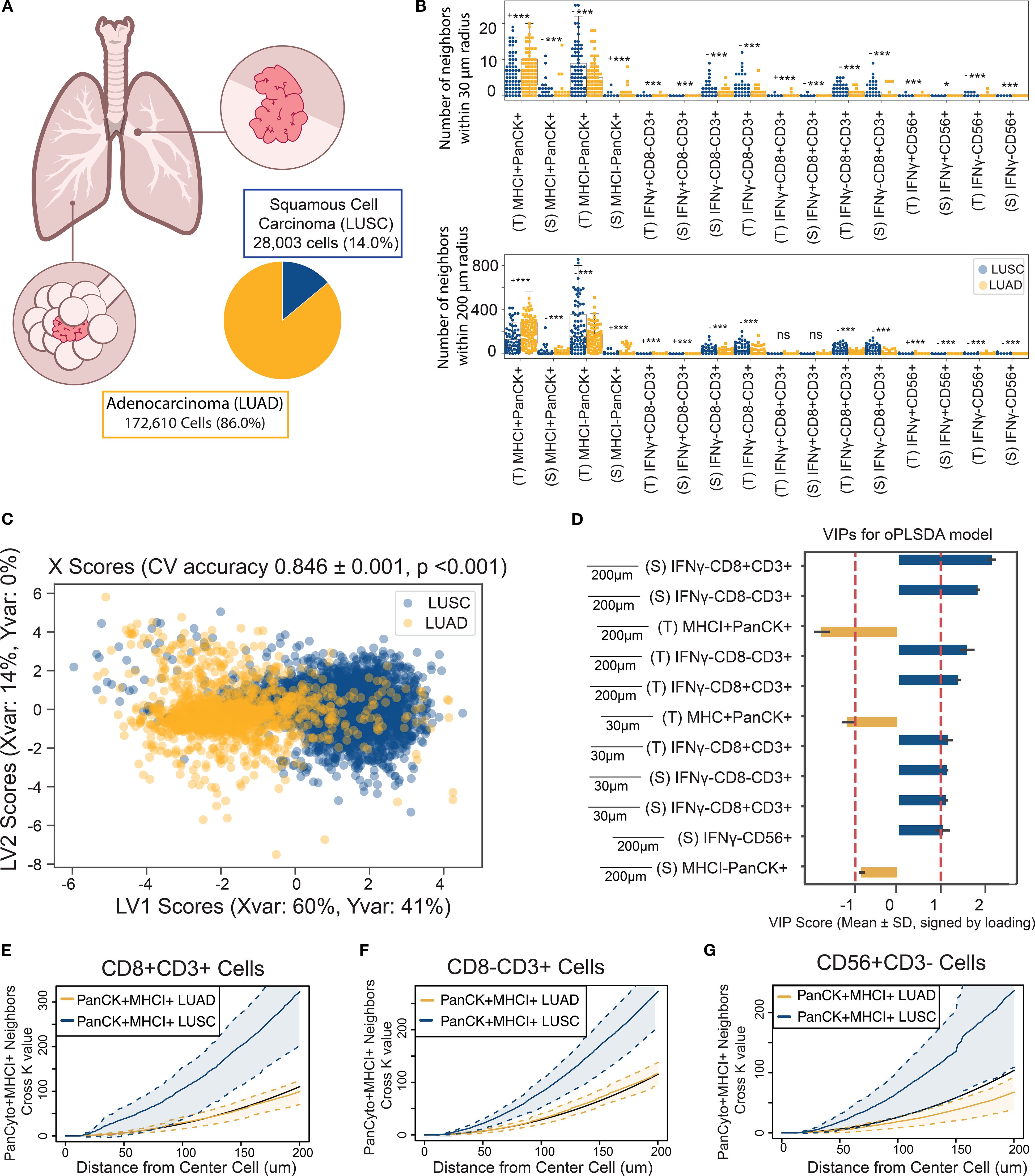 Diagram detailing lung cancer data analysis. Panel A shows lung structure with squamous cell carcinoma and adenocarcinoma percentages. Panel B presents cell marker data at 30 and 200 micrometer radii for LUSC and LUAD. Panel C is a scatter plot of LUSC and LUAD scores with cross-validated accuracy. Panel D lists variable importance in projection scores for OPLSDA. Panels E to G show graphs of CD8+CD3+ and CD56+CD3- cells against distance, comparing PanCK+MHC1+ neighbors in LUAD and LUSC.