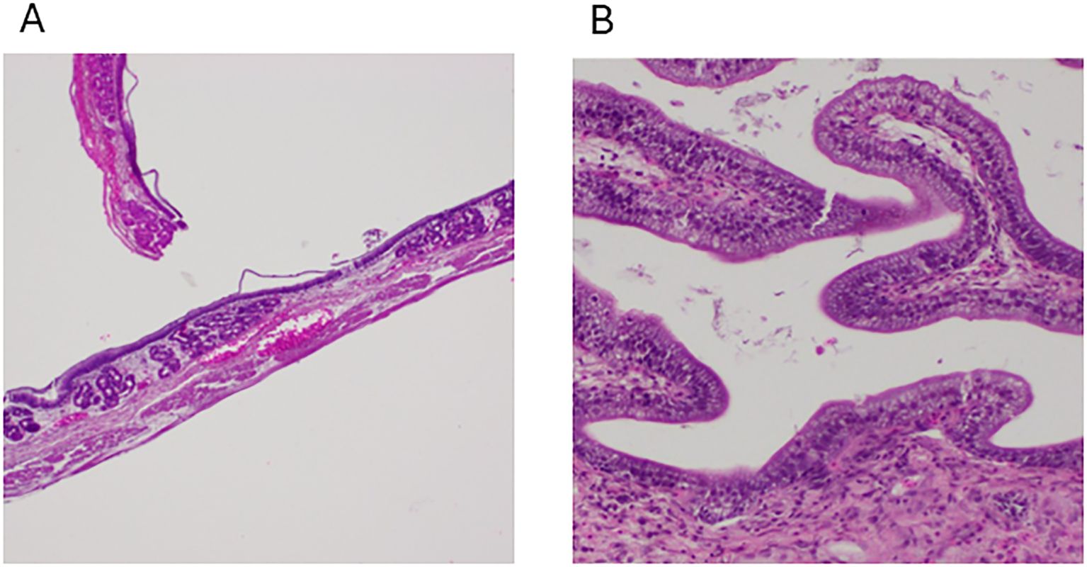 Two microscopic images labeled A and B showing two tissue samples in pink and purple staining. A shows the stomach with cylindrical structures (gastric glands), and B shows the intestines with goblet cell-like structures.