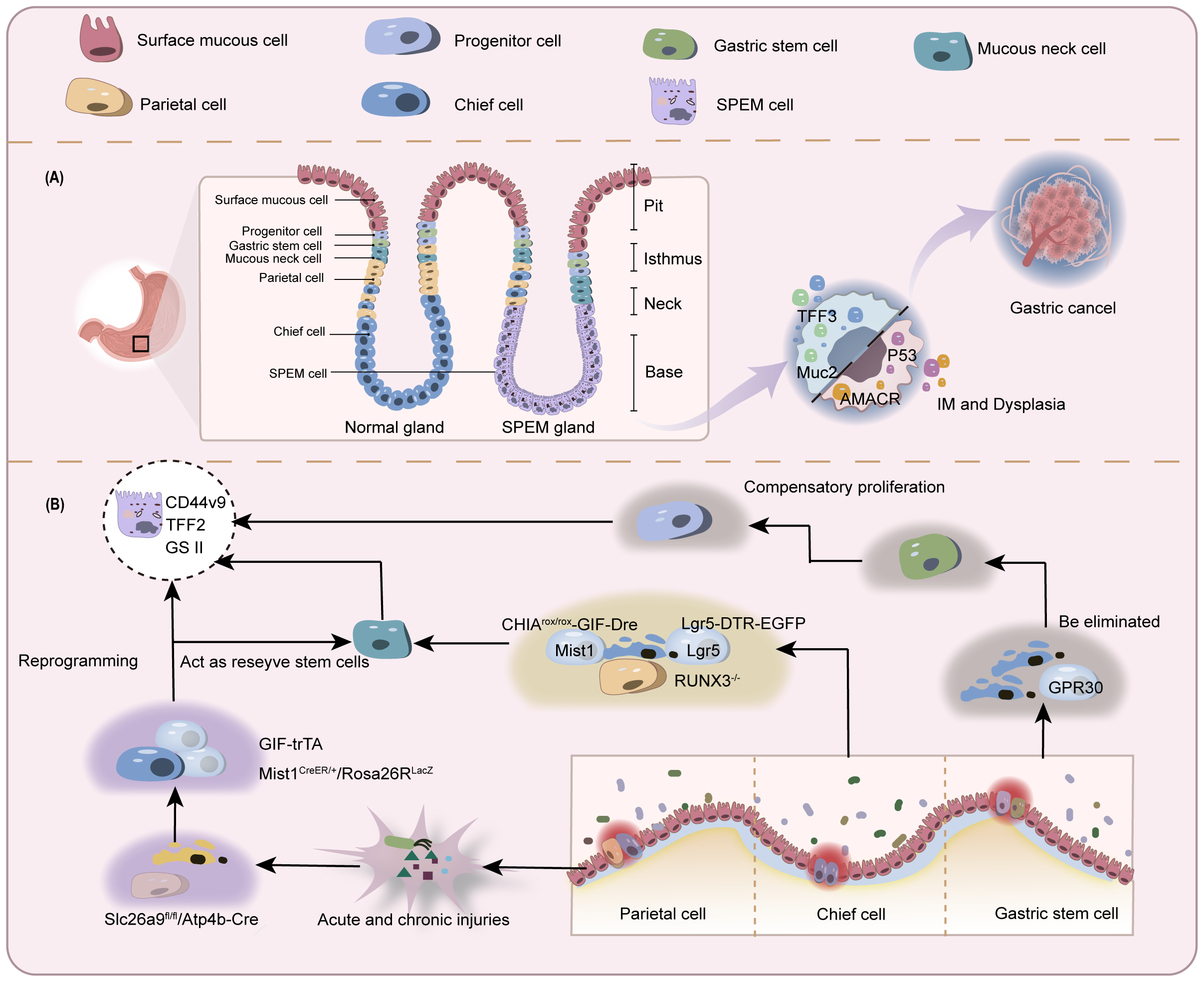 Diagram illustrating gastric cell development and transformation. Part A shows a comparison between normal and SPEM glands, highlighting cell types like surface mucous, progenitor, gastric stem, mucous neck, parietal, chief, and SPEM cells. A pathway leads from these structures to gastric cancer, involving markers like TFF3, Muc2, P53, and AMACR. Part B depicts processes related to reprogramming and compensatory proliferation, featuring actions of genes and proteins such as CD44v9, Mist1, Lgr5, and GPR30, in response to injuries. Each cell type is color-coded with a legend included.