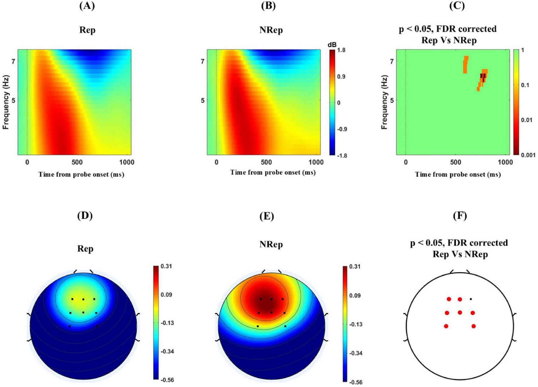 Heatmaps and topographical maps comparing theta power in “Rep” and “NRep” conditions. (A) and (B) display frequency vs. time data, with color representing decibels. (C) highlights significant differences in theta power with FDR correction, showing p-values. (D) and (E) are topographical maps for “Rep” and “NRep” with color indicating intensity levels. (F) shows significant electrode sites with FDR correction.