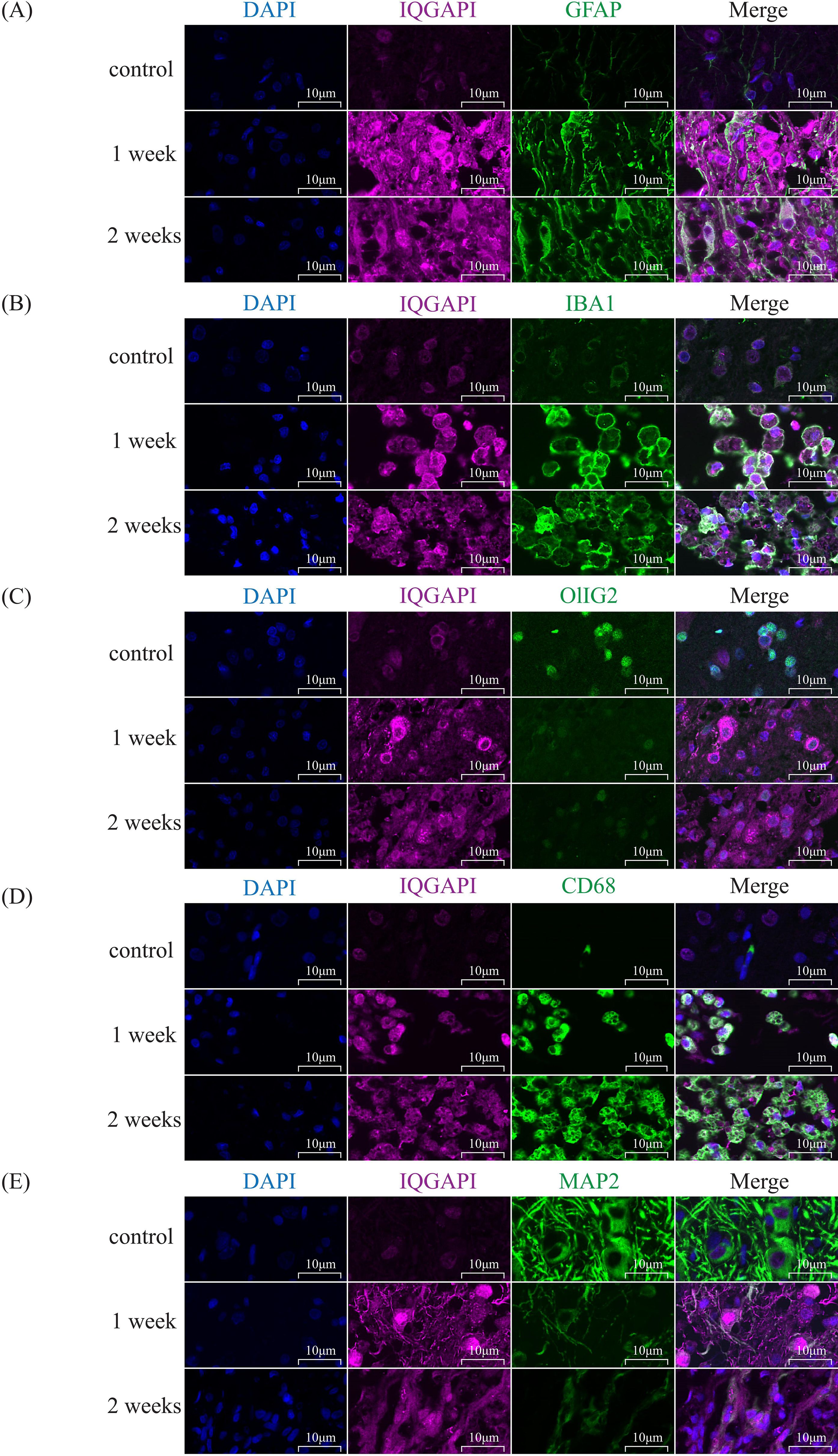 Fluorescence microscopy images showing the expression of IQGAP1 (magenta) in combination with various markers (green) and nuclei staining (DAPI, blue) across different time points: control, 1 week, and 2 weeks. (A) Shows GFAP marker, (B) IBA1 marker, (C) Olig2 marker, (D) CD68 marker, and (E) MAP2 marker. Each set includes separate and merged images to highlight co-localization. Scale bar is 10 micrometers.