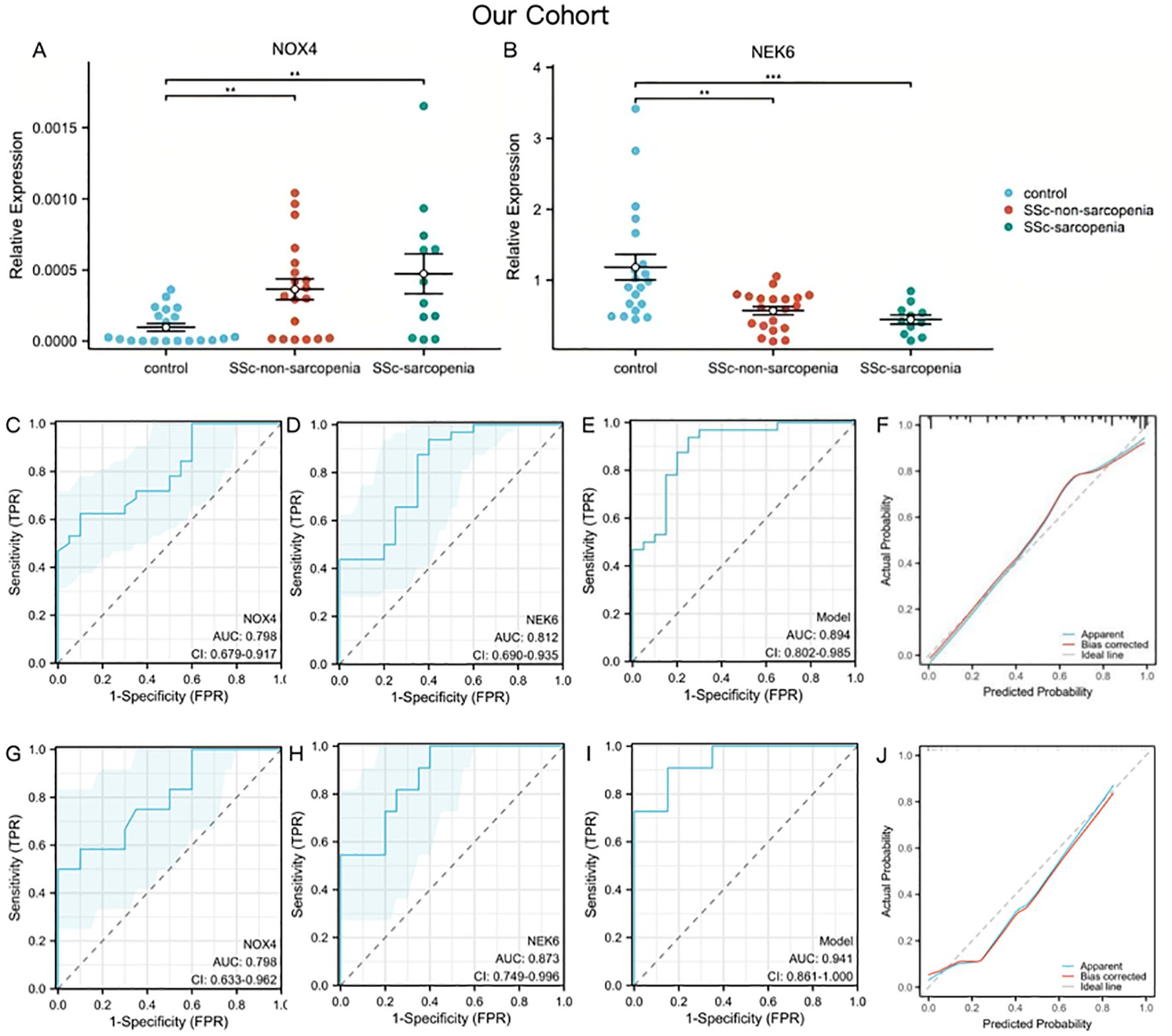 Graphs compare NOX4 and NEK6 expression levels and ROC curves in control, SSc-non-sarcopenia, and SSc-sarcopenia groups. Panels A and B show expression levels; panels C to J display ROC analysis with AUC values for NOX4, NEK6, and combined models.