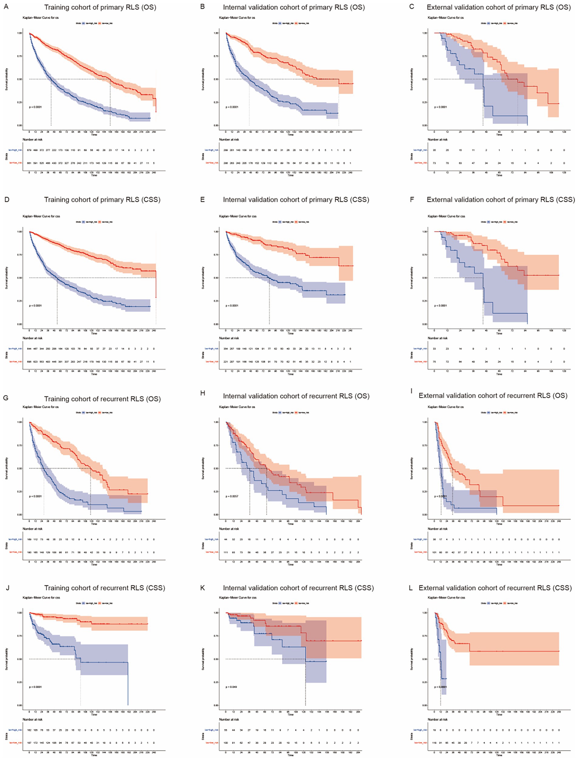 Twelve Kaplan-Meier survival curves showing overall survival (OS) and cancer-specific survival (CSS) for primary and recurrent retroperitoneal liposarcoma (RLS) across training, internal, and external validation cohorts. Each graph includes survival probability over time, with color-coded bands representing confidence intervals, and tables indicating the number of patients at risk at different time points.