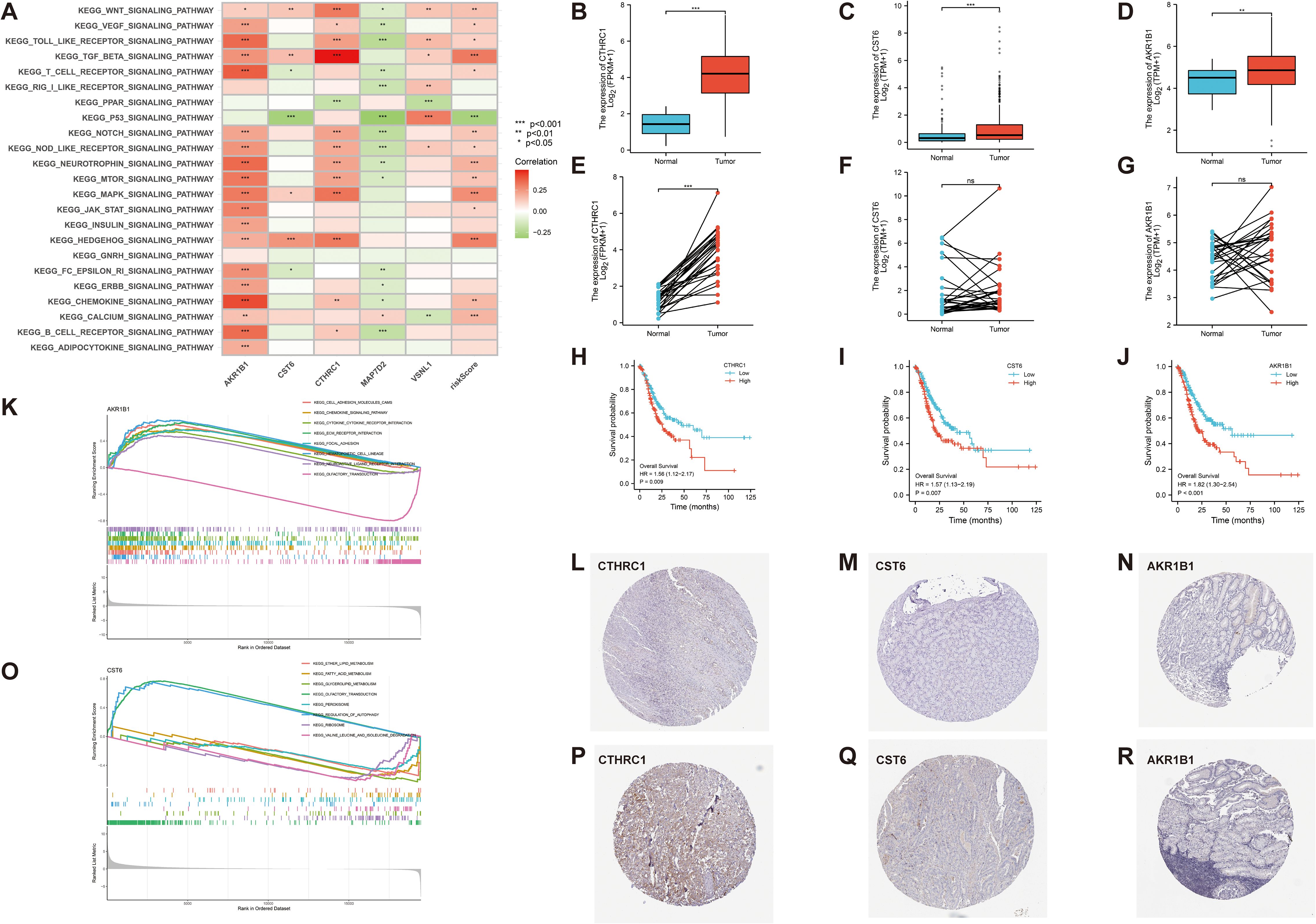 Heatmap A displays pathway correlations, with varying colors indicating degrees of correlation. Box plots B, C, and D show gene expression differences between normal and tumor samples. Line charts E, F, and G illustrate paired expression changes. Survival curves H, I, and J compare low and high gene expression groups. Gene set enrichment plots K and O highlight pathways related to different genes. Panels L, M, N, P, Q, and R feature tissue stain images for specific proteins.