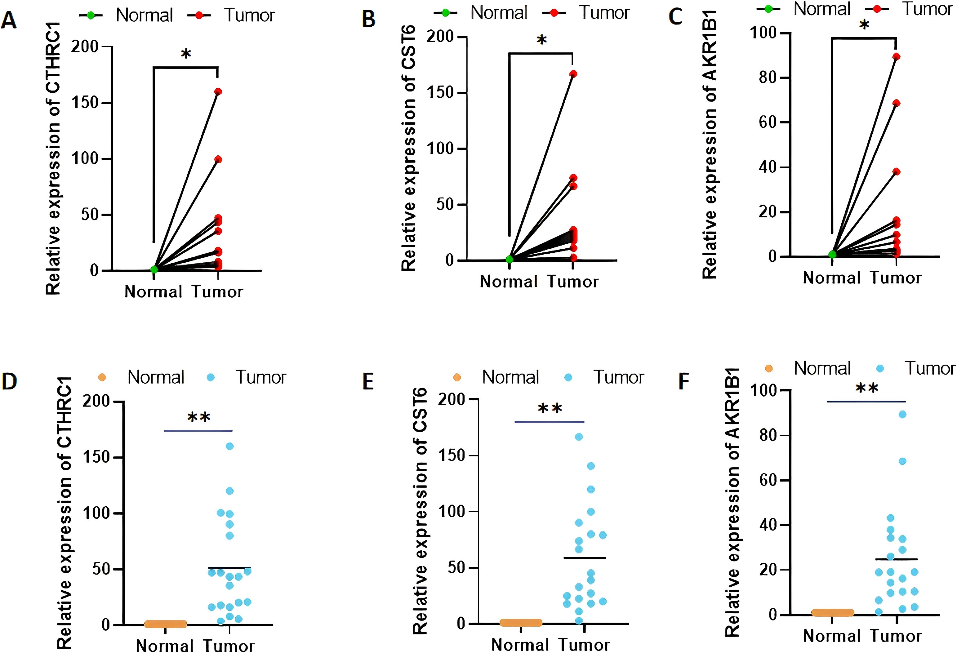 Graphs A to F show the relative expression of CTHRC1, CST6, and AKR1B1 in normal versus tumor tissues. Graphs A, B, and C display line charts with increased expression in tumor samples marked by red dots. Graphs D, E, and F depict scatter plots with blue dots indicating significantly higher expression in tumor samples, noted with asterisks. Comparisons show significant differences between normal and tumor groups.