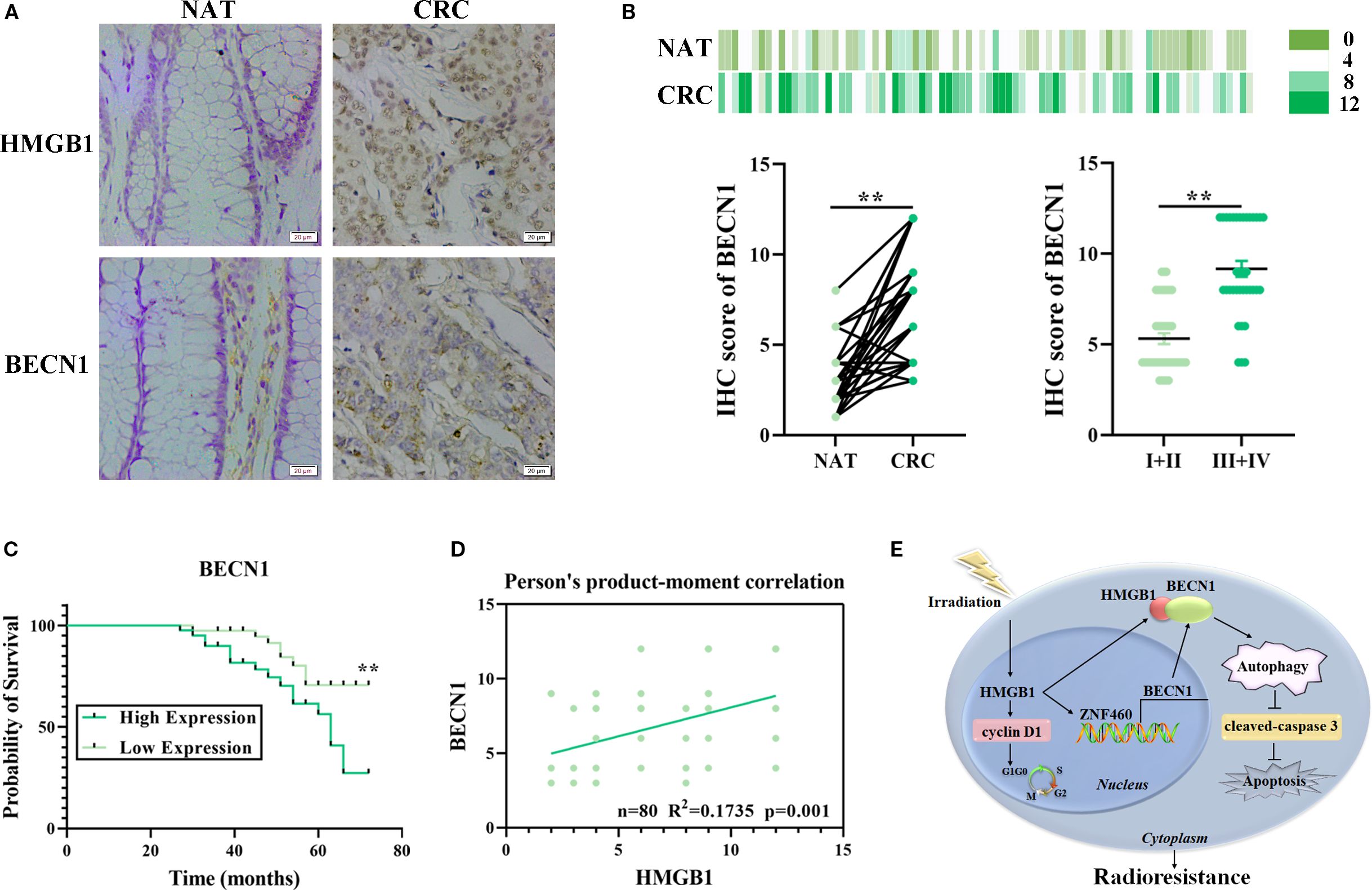 A multi-panel scientific figure with the following elements: (A) Microscopic images showing HMGB1 and BECN1 expression in NAT and CRC tissues. (B) Heatmap and dot plots comparing IHC scores of BECN1 in NAT vs. CRC and different stages. (C) Kaplan-Meier survival curve indicating probability of survival related to BECN1 expression. (D) Scatter plot showing correlation between HMGB1 and BECN1. (E) Diagram illustrating HMGB1 and BECN1's role in autophagy, apoptosis, and radioresistance.