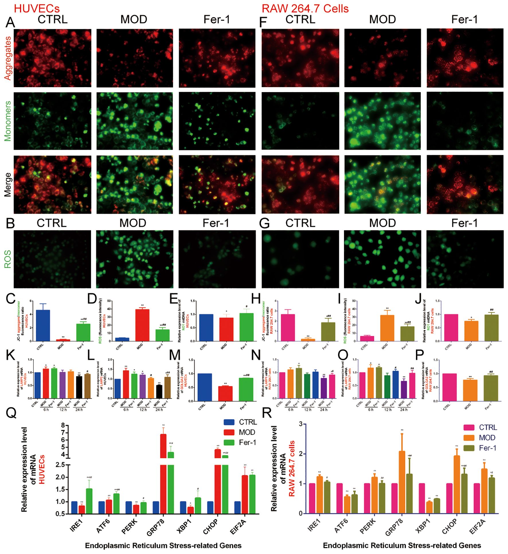 Microscopy and bar chart analysis of HUVECs and RAW 264.7 cells under CTRL, MOD, and Fer-1 conditions. Panels A and F show aggregates and monomers in red and green fluorescence, with merged images indicating overlap. Panels B and G display ROS levels in green. Panels C-P present bar charts illustrating levels of aggregates, monomers, and ROS. Panels Q and R show relative mRNA expression levels of endoplasmic reticulum stress-related genes in HUVECs and RAW 264.7 cells, respectively, with different treatment conditions indicated by colored bars. Statistical significance is marked by asterisks.