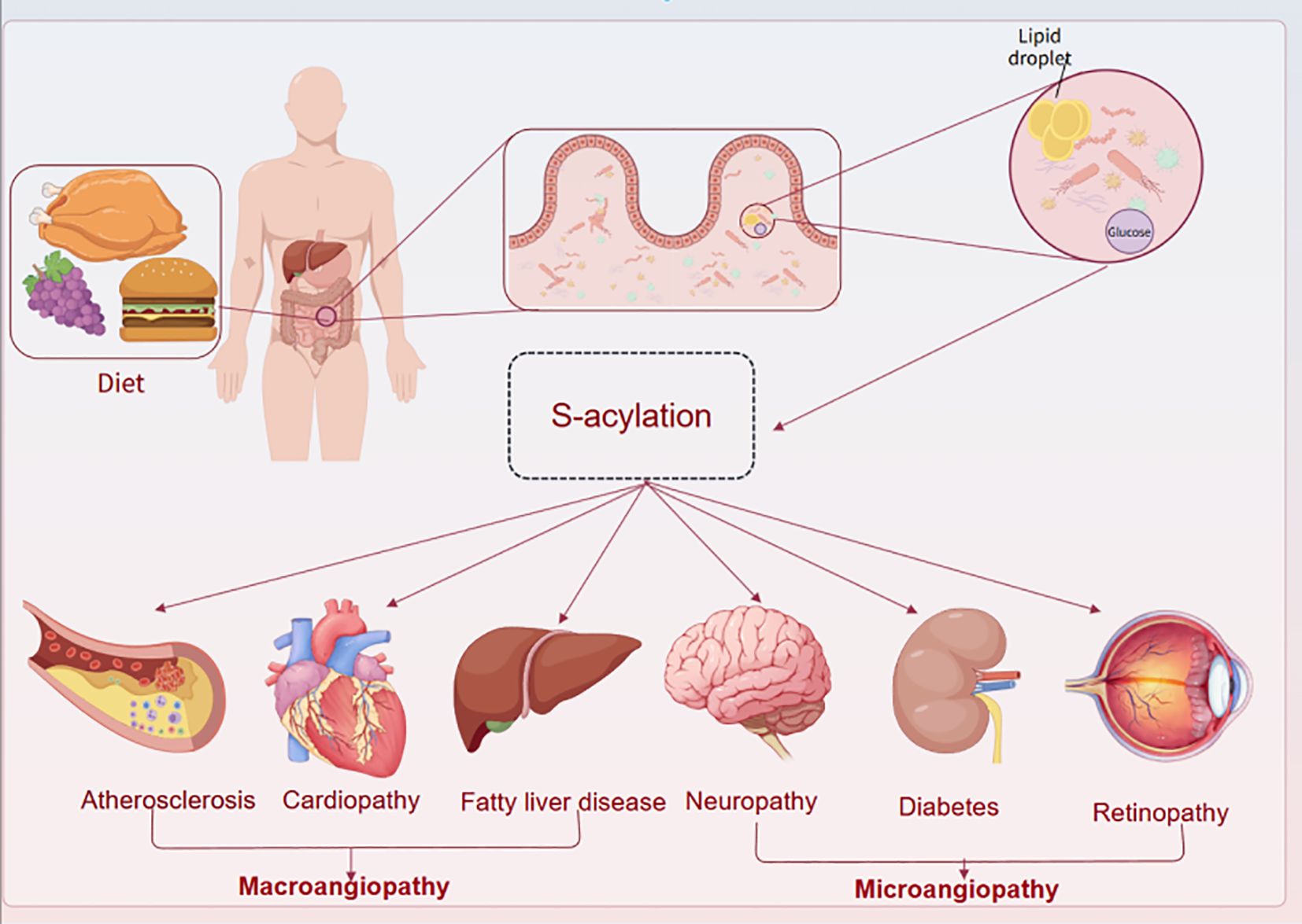 Diagram illustrating the impact of diet and S-acylation on health. A human figure with internal organs highlighted is linked to a section of the intestine showing lipid droplets and glucose. Below, S-acylation is connected to health conditions: atherosclerosis, cardiopathy, fatty liver disease, neuropathy, diabetes, and retinopathy, divided into macroangiopathy and microangiopathy categories.