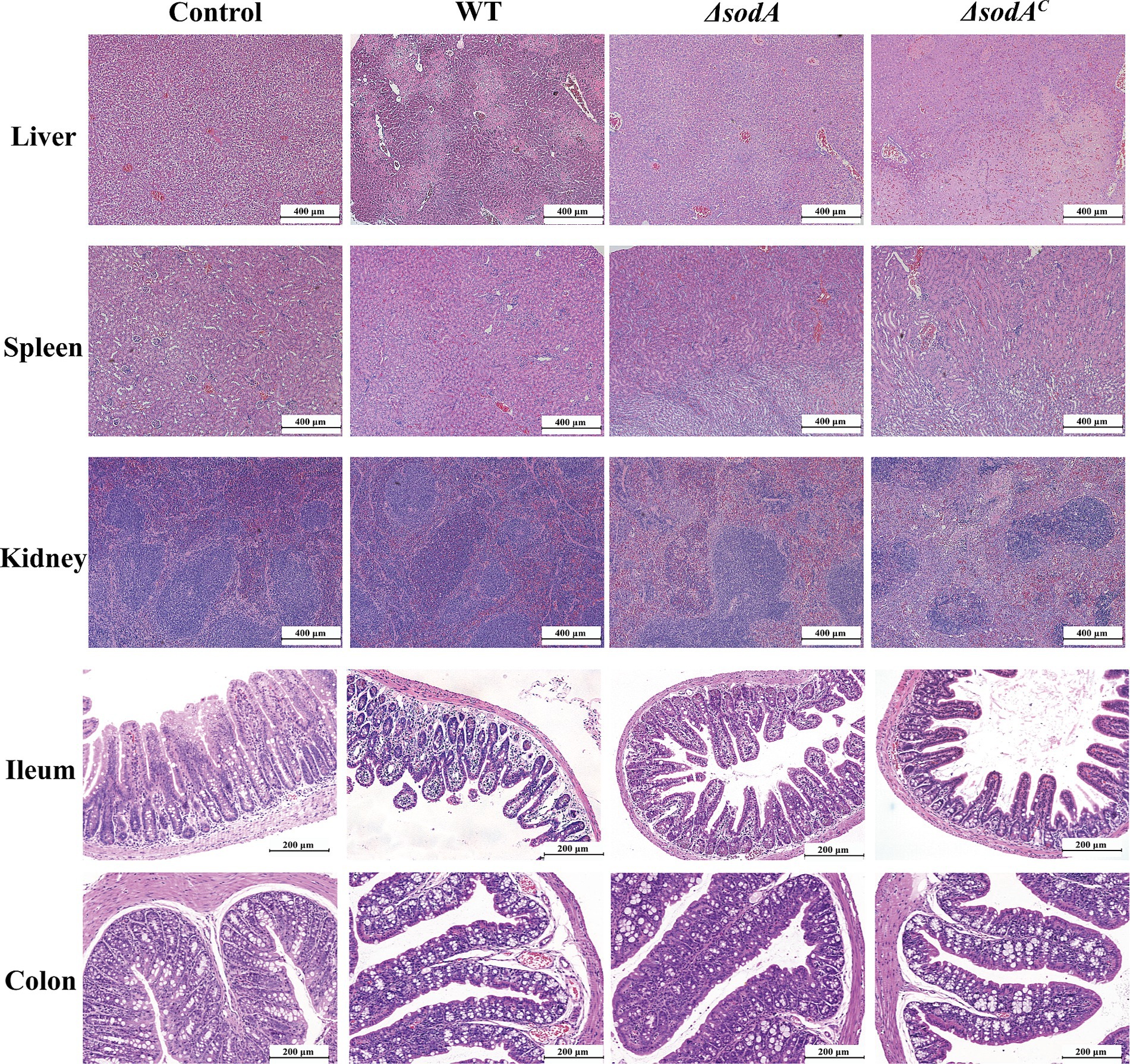 Microscopic images of liver, spleen, kidney, ileum, and colon tissues under four conditions: Control, WT, ΔsodA, and ΔsodA^c. Each row represents one type of tissue, and each column corresponds to one condition. The scale bars indicate magnifications of 400 micrometers for liver, spleen, and kidney, and 200 micrometers for ileum and colon.