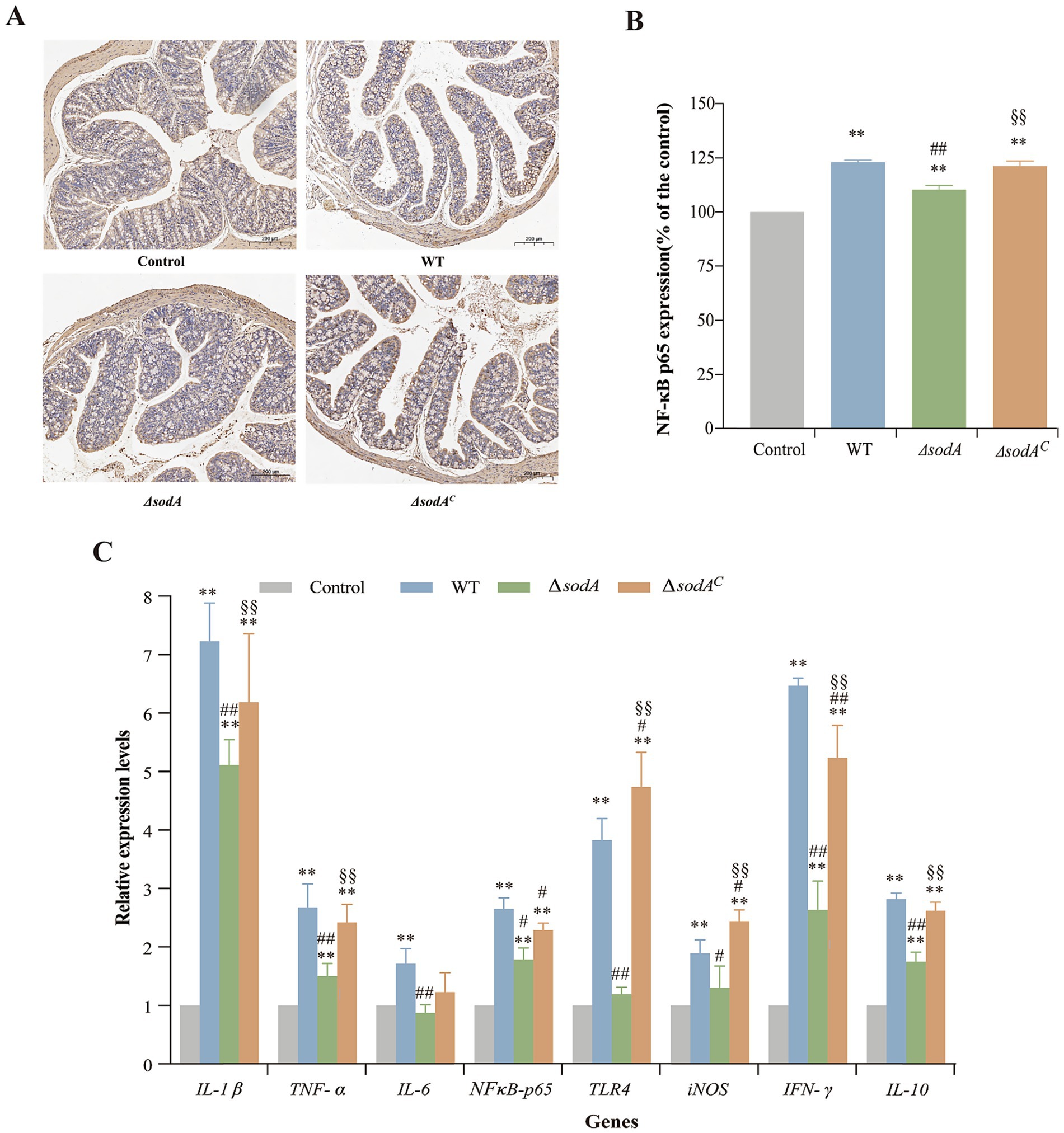 Panel A shows histological images comparing intestinal tissues from control, WT, ΔsodA, and ΔsodA^C groups. Panel B is a bar graph illustrating NF-κB p65 expression as a percentage of control across these groups, showing significant increases in ΔsodA^C. Panel C presents a bar graph of relative expression levels of various genes (IL-1β, TNF-α, IL-6, NFκB-p65, TLR4, iNOS, IFN-γ, IL-10) for the same groups, indicating differential expression with statistical significance.