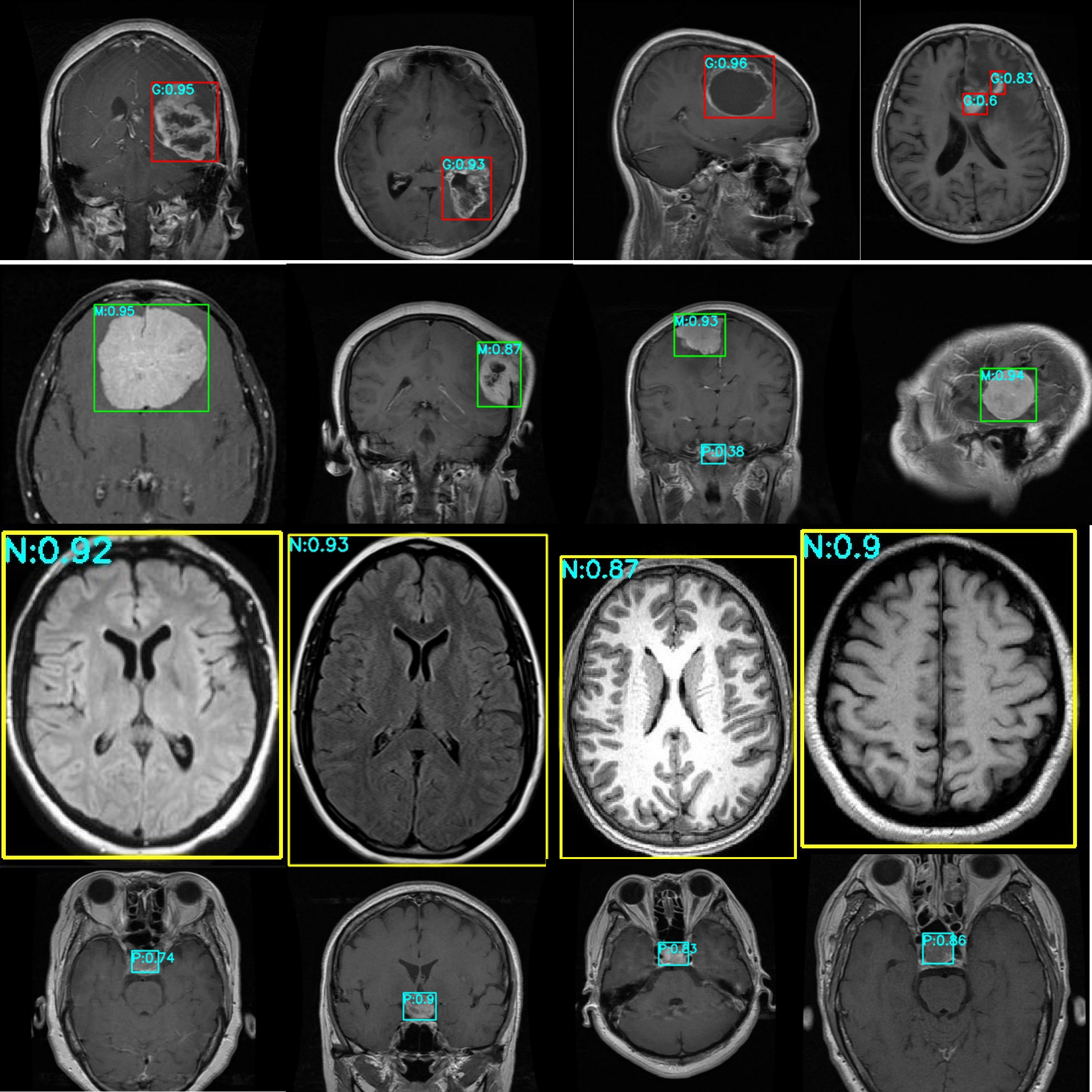 The figure presents the test results for the Kaggle brain tumor dataset. The red box and G represents Glioma, the green box and M represents Meningioma, the yellow box and N represent No tumor, the cyan box and P represents Pituitary. The numbers behind represent the probability value of belonging to this class.