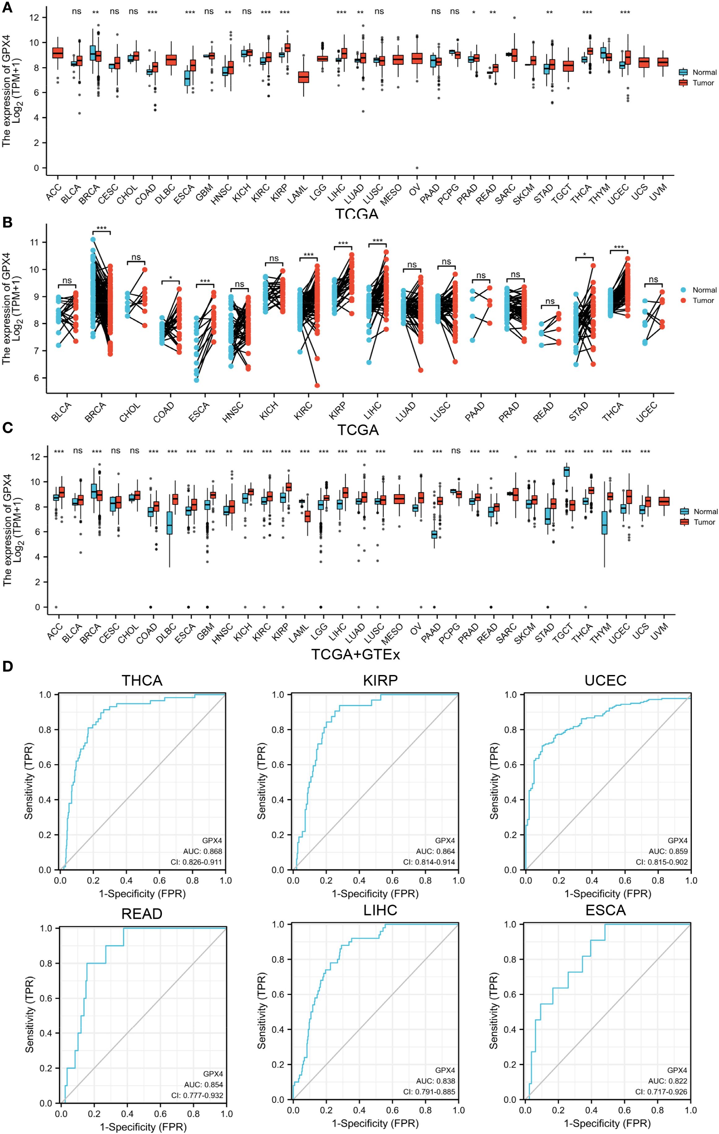 Box plots and ROC curves analyzing GPX4 expression across multiple cancer types. Panels A, B, and C show GPX4 expression in normal and tumor samples from TCGA and TCGA+GTEx datasets, respectively, with significant differences marked. Panel D displays ROC curves for six cancer types: THCA, KIRP, UCEC, READ, LIHC, and ESCA, showing the diagnostic performance of GPX4 with AUC values provided.