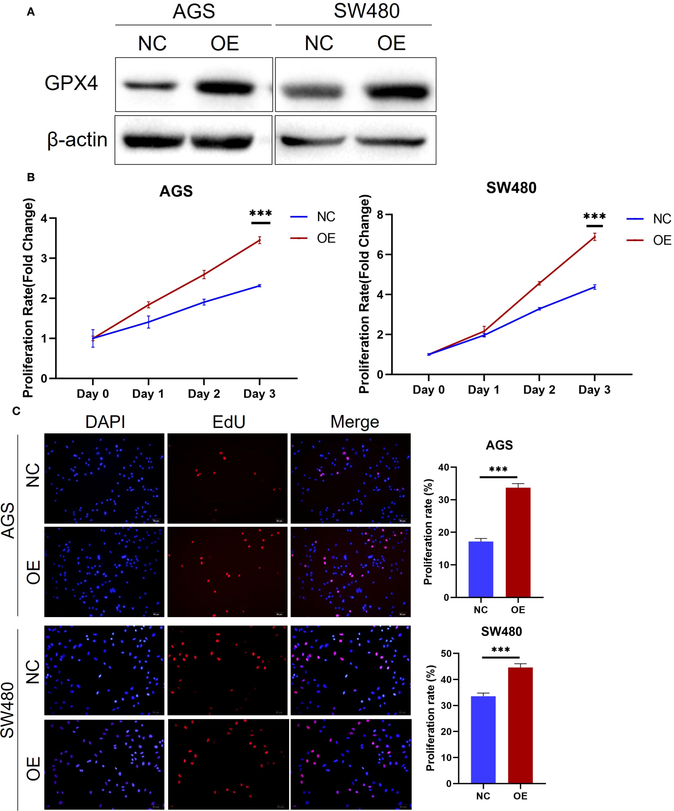 (A) Western blot analysis showing GPX4 and β-actin levels in AGS and SW480 cells with normal control (NC) and overexpression (OE). (B) Line graphs display proliferation rates of AGS and SW480 cells over three days, with OE showing higher proliferation. (C) Fluorescence images of AGS and SW480 cells stained with DAPI and EdU, alongside merged images. Bar graphs illustrate increased proliferation rates in OE compared to NC, with statistical significance indicated.