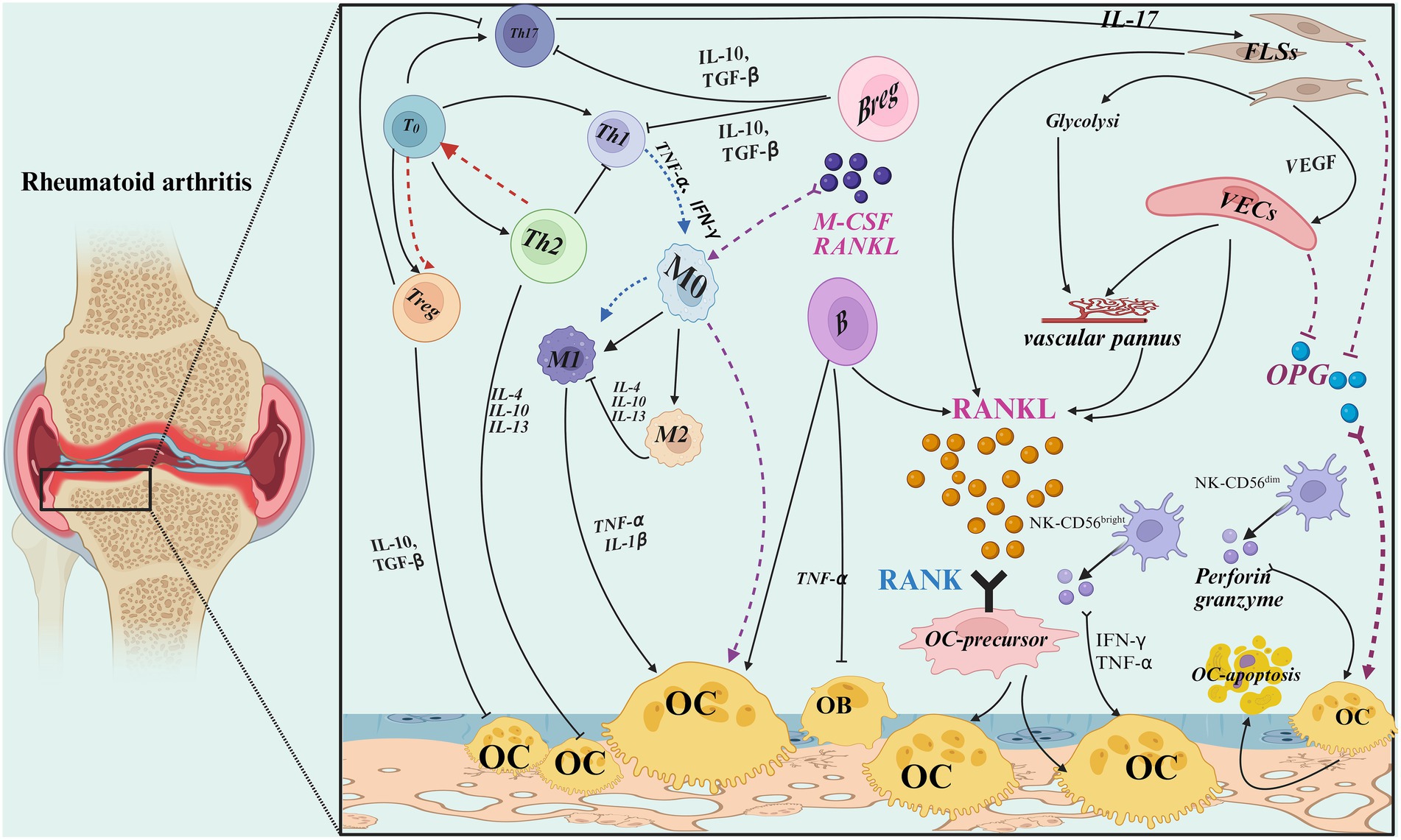 Diagram depicting the mechanisms involved in rheumatoid arthritis, showing interactions between various cells and cytokines. Includes Th cells, macrophages, fibroblast-like synoviocytes (FLSs), vascular endothelial cells (VECs), osteoclasts (OC), and signaling molecules like RANKL and OPG. Arrows illustrate cytokine communication pathways such as IL-10, TGF-β, TNF-α, and others, highlighting the inflammation and bone erosion process. A cross-section of a joint is shown to the left.