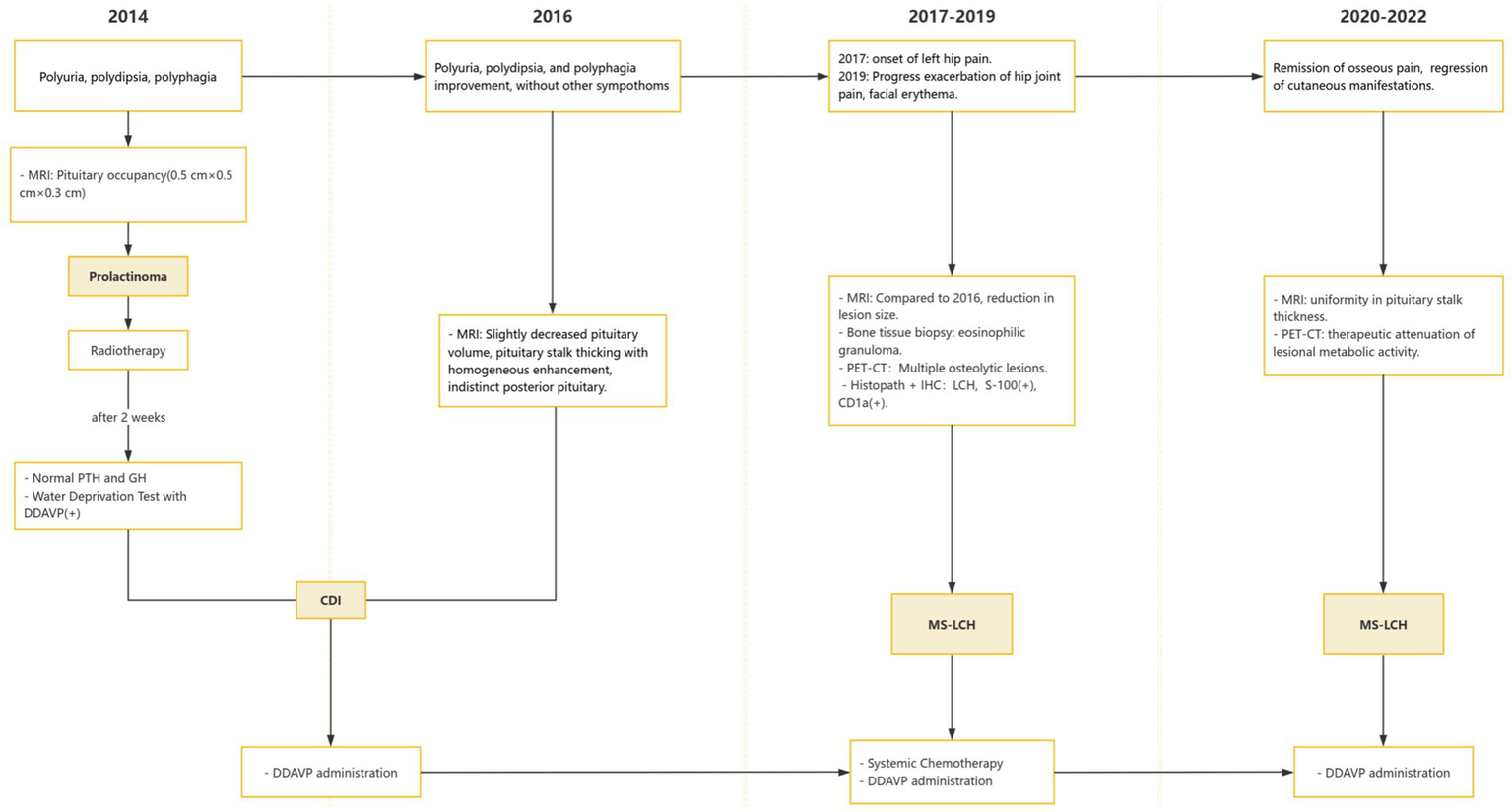 Flowchart illustrating the clinical course from 2014 to 2022. In 2014, the patient presented with polyuria, polydipsia, and polyphagia, and prolactinoma was diagnosed, followed by radiotherapy. A subsequent water deprivation test confirmed central diabetes insipidus (CDI), and DDAVP treatment was initiated. By 2016, symptoms improved and pituitary volume decreased. Hip pain developed in 2017 and worsened by 2019, when multi-system Langerhans cell histiocytosis (MS-LCH) was diagnosed and treated with chemotherapy. From 2020 to 2022, pain and skin lesions resolved, and MRI and PET-CT showed therapeutic response.