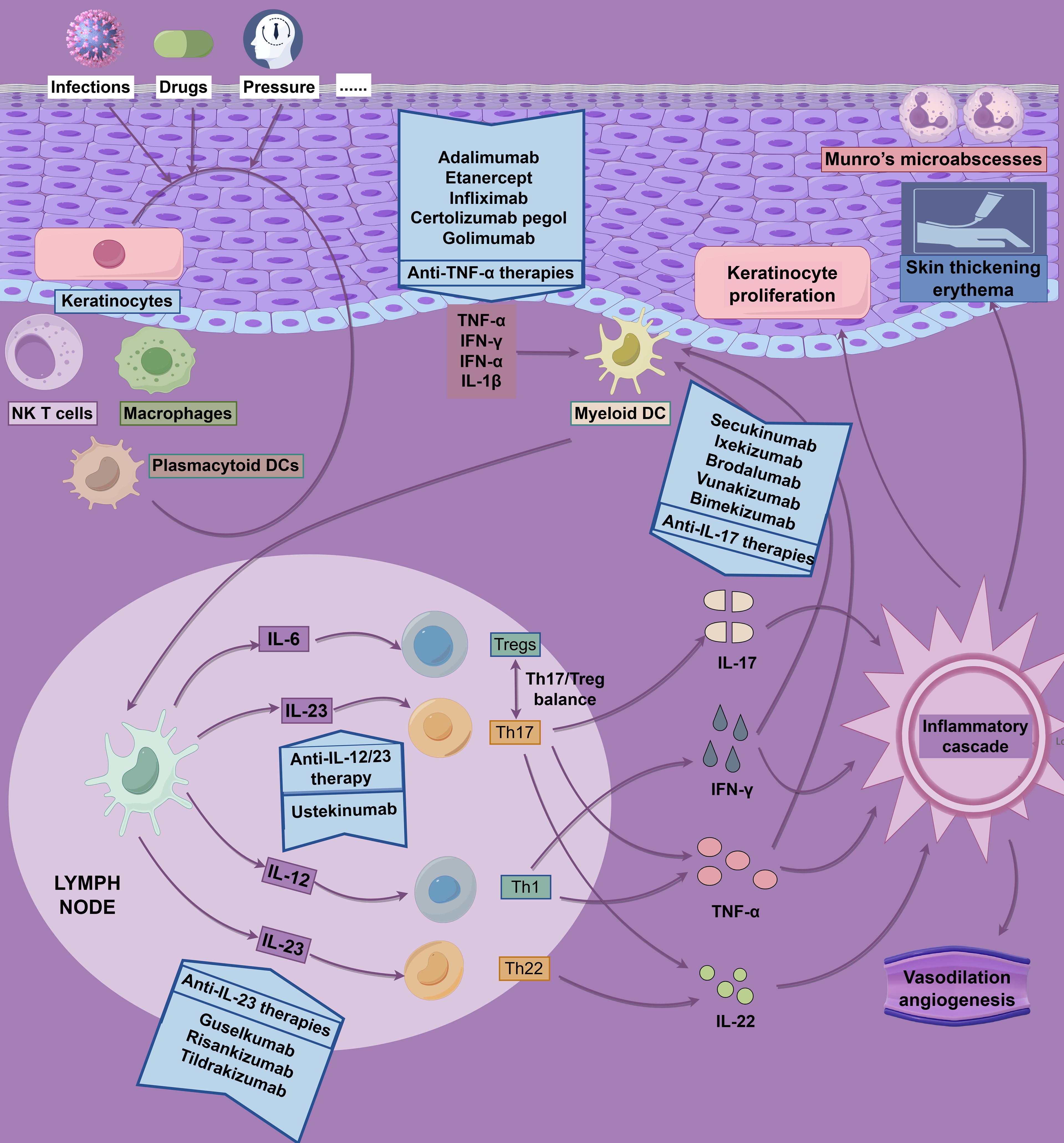 Diagram illustrating the pathology of psoriasis, highlighting immune cell interactions and therapeutic targets. Key elements include keratinocyte proliferation, inflammatory cytokines like TNF-α, IFN-γ, IL-23, and IL-17, and associated therapies. Various cells such as NK T cells, macrophages, and dendritic cells are involved. Treatments, like anti-TNF-α therapies, counteract inflammation, while factors like infections, drugs, and pressure influence disease triggers. Effects include skin thickening, erythema, and microabscesses, with lymph node activities linked to Th1, Th17, and Th22 cells. The diagram emphasizes the balance between Th17 and regulatory T cells (Tregs).