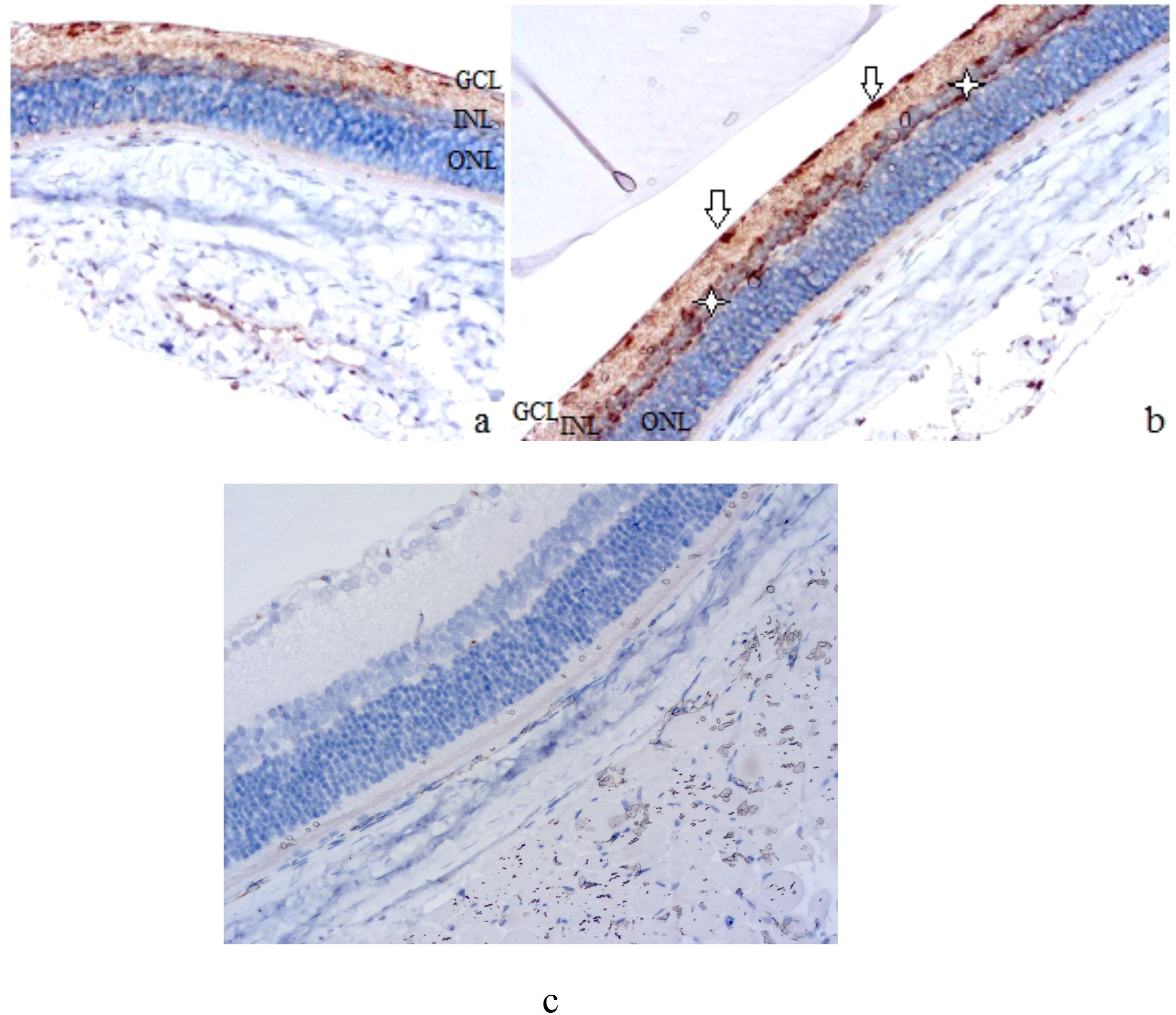 Histological sections of retinal tissue are shown in panels a, b, and c. Panel a displays three layers labeled GCL, INL, and ONL with darker staining in the GCL. Panel b shows increased staining intensity in the GCL with arrows indicating specific areas of interest. Stars highlight different regions. Panel c has less staining, depicting the same layers with increased clarity in cellular structures.