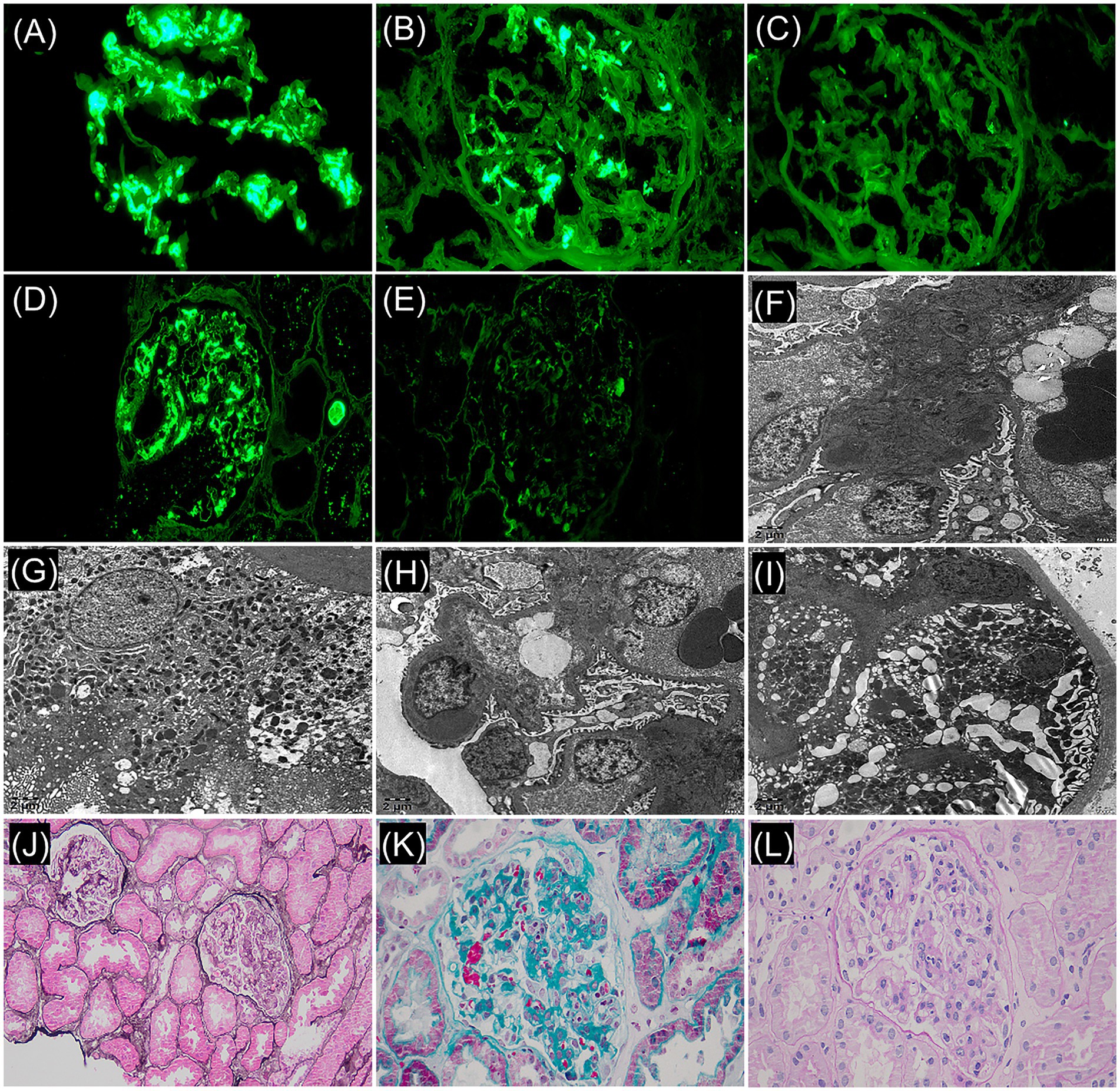 Panel of twelve microscopic images labeled A to L. Panels A to E show fluorescent green staining, with varying intensity and distribution in a cellular network. Panels F to I display black and white electron microscopy images showing fine cellular details and structures. Panels J and L are stained tissue sections in shades of pink and purple, highlighting cellular structures. Panel K is a stained section in pink and blue, emphasizing different tissue components. Each panel represents different techniques and staining to examine cellular or tissue morphology.