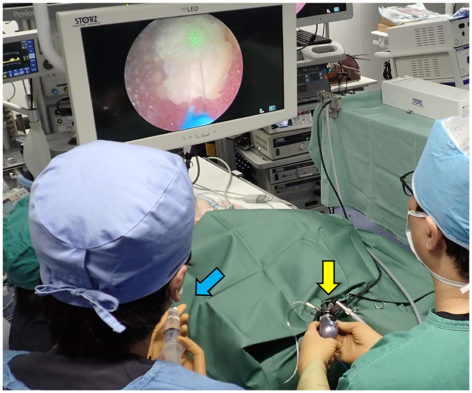 Two medical professionals perform a surgical procedure in an operating room. One holds a syringe, indicated by a blue arrow, while the other uses a surgical tool, indicated by a yellow arrow. They focus on a monitor displaying an endoscopic view. Medical equipment surrounds them.