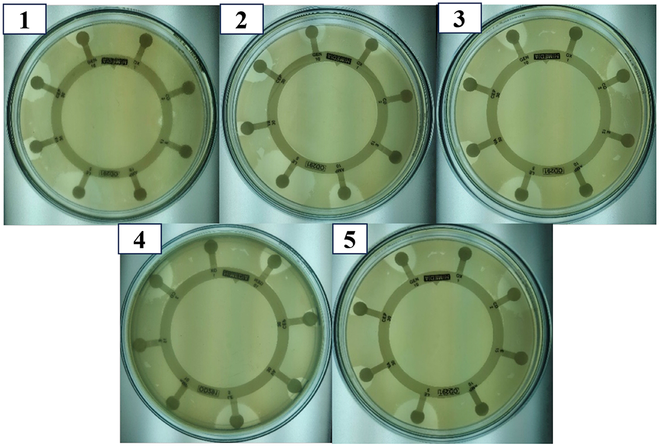 Five petri dishes with numbered labels display the bacterial lawn cultures and antibiotic sensitivity discs, arranged radially. Each disc has a different antibiotic. There are distinct zones of inhibition around each disc, showing varying effectiveness.