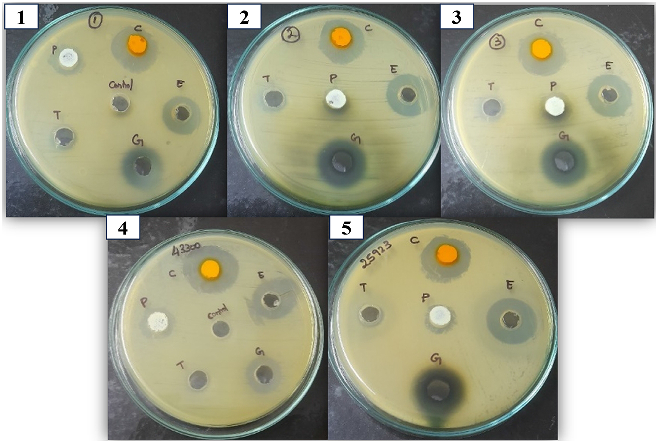 Five petri dishes display different antibacterial activity test results. Each dish contains labels: P, E, G, T, C, and Control. Zones of inhibition vary in size, indicating differing bacterial resistance or susceptibility to the bioactive compounds.