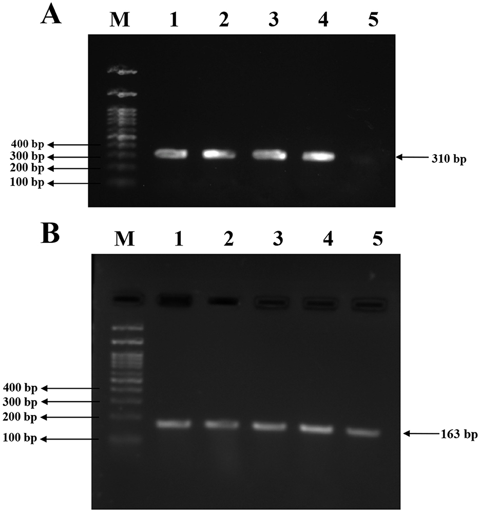 A gel electrophoresis image with two panels labeled A and B. Panel A shows five lanes with lane M as a molecular marker ladder indicating bands at 100, 200, 300, and 400 base pairs. Lanes 1 to 5 show bands at approximately 310 base pairs. Panel B shows a similar setup with bands at approximately 163 base pairs in lanes 1 to 5, using the same molecular marker ladder.