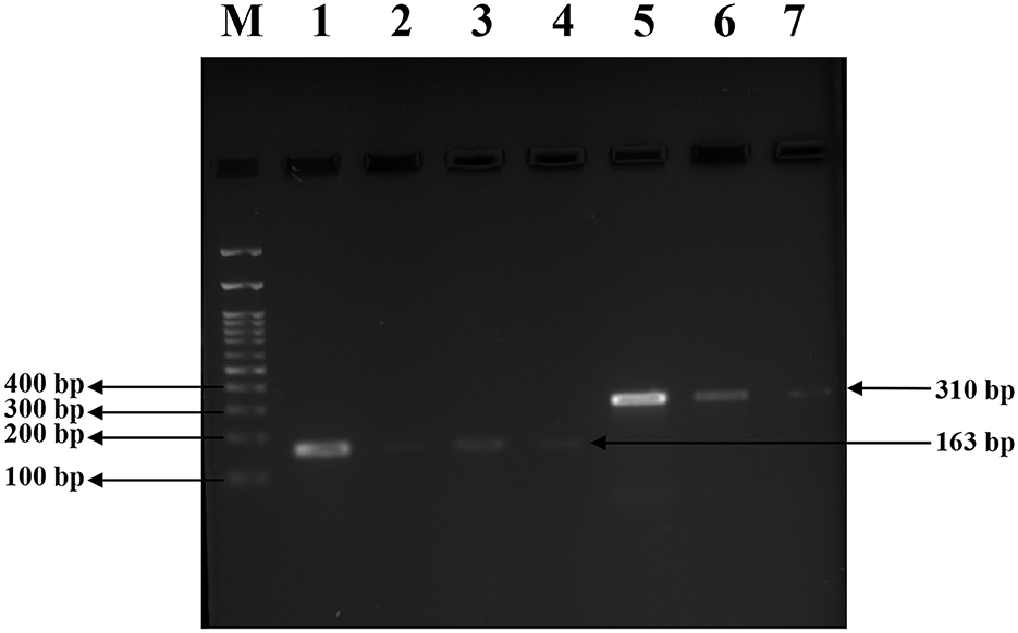 Gel electrophoresis image showing DNA bands in lanes labeled M, 1 to 7. Lane M contains a DNA ladder with bands at 400, 300, 200, and 100 base pairs. Lanes 1 has bright band at 163 base pairs, and Lane 5 has band at 310 base pairs, indicating successful amplification.