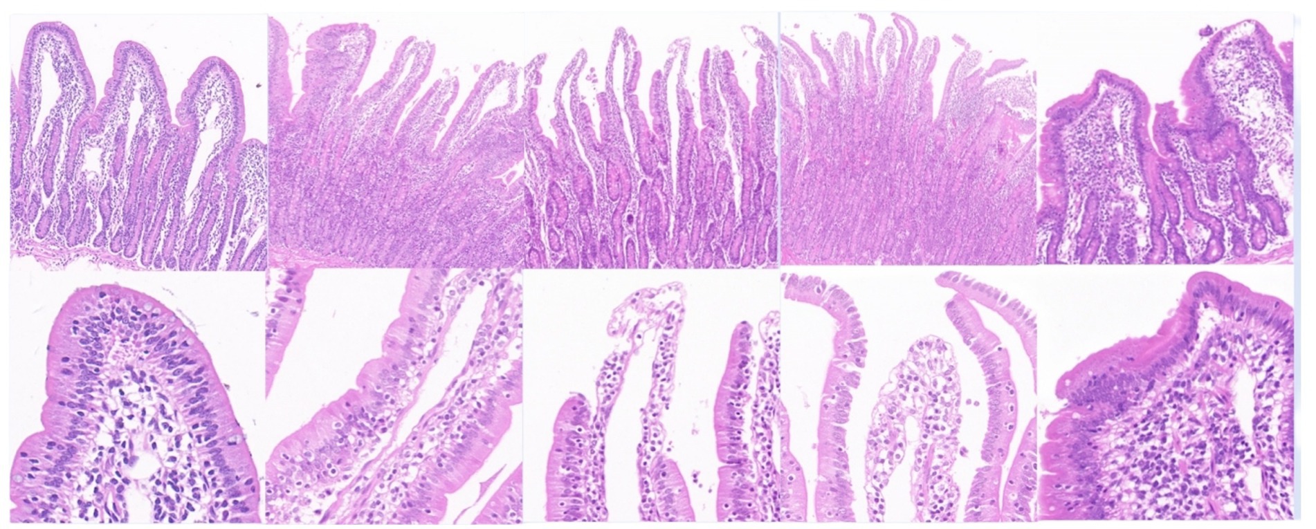 Microscopic images of small intestine tissue stained with hematoxylin and eosin (H&E). The images show the mucosal layer with villi structures, crypts, and epithelial cells with varying cellular and structural detail. The purple and pink staining highlights the different cell types and tissue architecture.