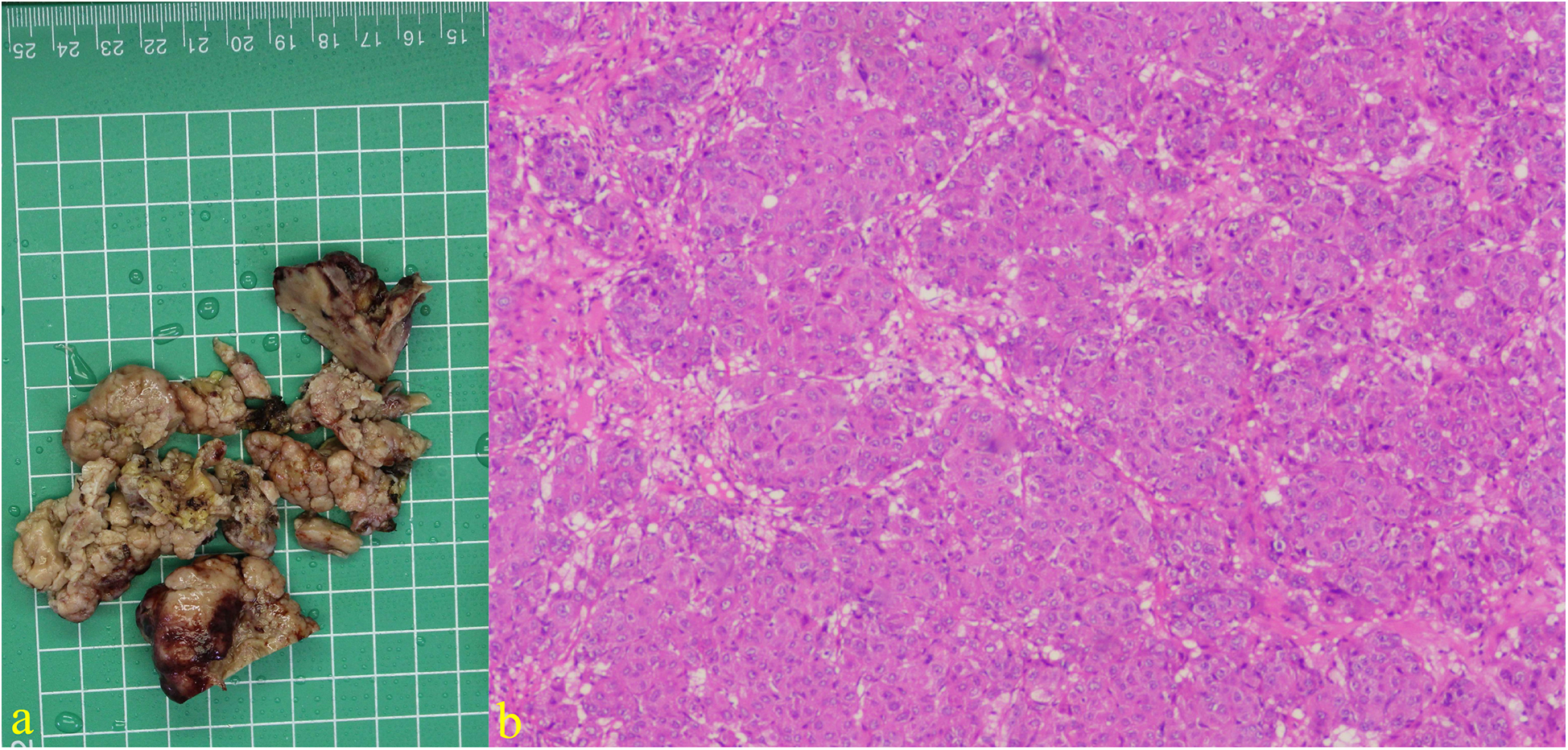 Two-panel image. Panel a shows several irregular, brown tissue samples on a green grid with measurements. Panel b is a microscopic view of tissue stained pink and purple, indicating cellular structure detail.