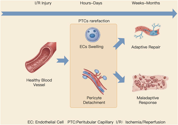 Illustration depicting ischemia/reperfusion (I/R) injury process over time, showing a healthy blood vessel transitioning to endothelial cell (EC) swelling and pericyte detachment, leading to either adaptive repair or maladaptive response. Labels indicate the time frame from hours to weeks or months. Key terms include EC: Endothelial Cell, PTC: Peritubular Capillary, I/R: Ischemia/Reperfusion.