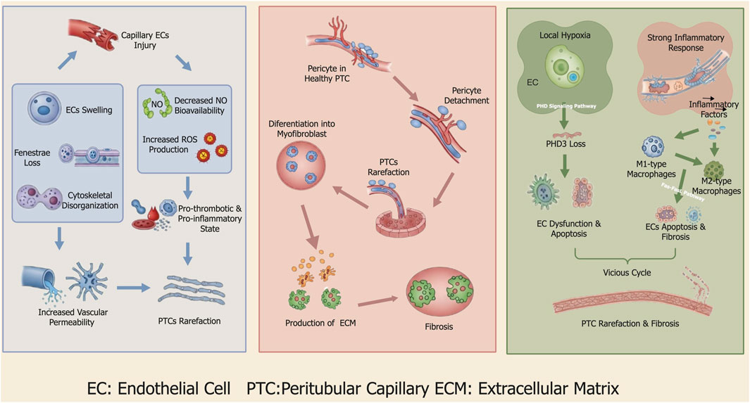 Diagram illustrating the progression of endothelial cell dysfunction leading to fibrosis. The left panel shows capillary endothelial cell injury, causing swelling, fenestrae loss, and increased vascular permeability. The middle panel depicts pericyte detachment from healthy peritubular capillaries, differentiation into myofibroblasts, and increased extracellular matrix production, resulting in fibrosis. The right panel highlights local hypoxia triggering EC dysfunction, apoptosis, and strong inflammatory responses involving macrophages, exacerbating fibrosis in a vicious cycle.