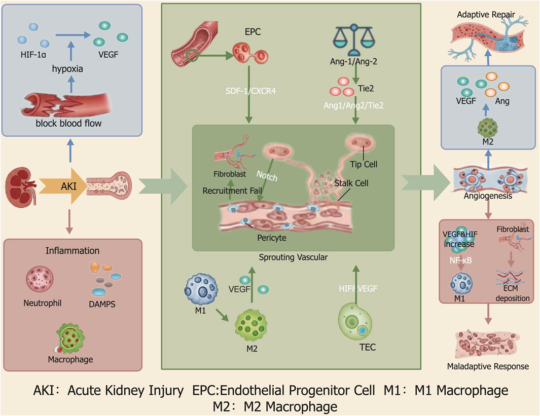 Flowchart illustrating the process of acute kidney injury (AKI) and its consequences. It begins with hypoxia, triggering HIF-1α and VEGF, leading to blocked blood flow. AKI results in inflammation involving neutrophils, DAMPs, and macrophages. Endothelial progenitor cells and other factors contribute to either failed recruitment or adaptive repair via angiogenesis. Key elements include fibroblasts, angiopoietins, and macrophage differentiation (M1 and M2). Outcomes are either adaptive repair or maladaptive response, with increased VEGF, HIF, NF-κB, and ECM deposition. Labels identify various cell types and processes.