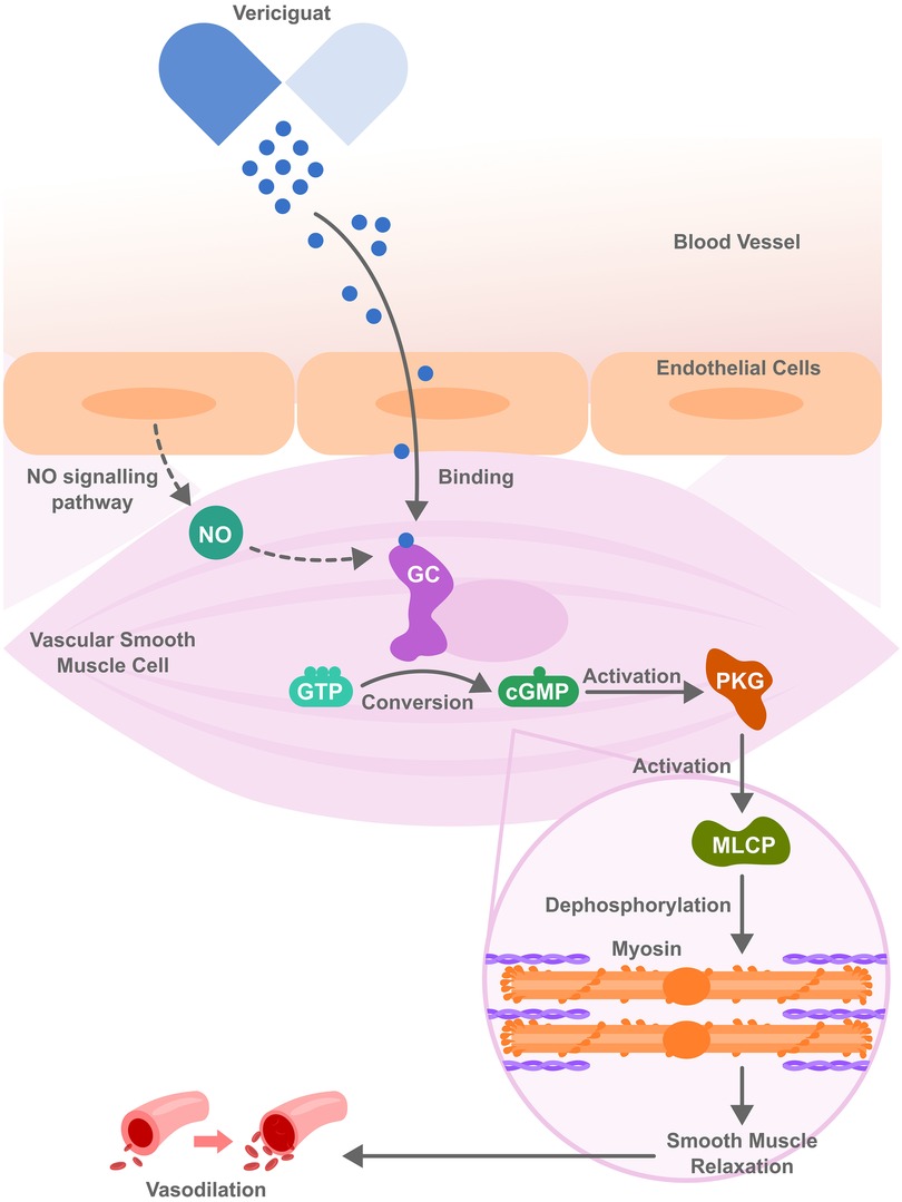 Illustration of the nitric oxide signaling pathway activated by Vericiguat. Vericiguat binds to endothelial cells, enhancing guanylate cyclase (GC) activity. GC converts GTP to cGMP, activating protein kinase G (PKG). PKG stimulates myosin light chain phosphatase (MLCP), leading to dephosphorylation of myosin, resulting in smooth muscle relaxation and vasodilation.