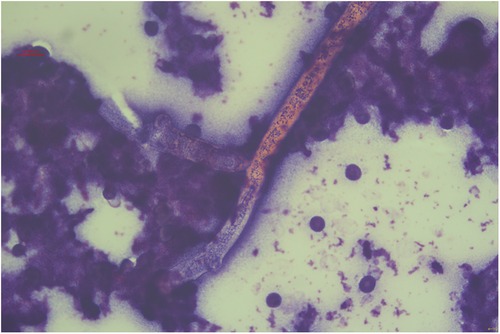 Panel A shows a piece of tissue next to a ruler for scale, on a denim surface. Panel B depicts a surgical scene revealing internal body tissues, with arrows indicating a specific area of interest. The area is surrounded by medical instruments.