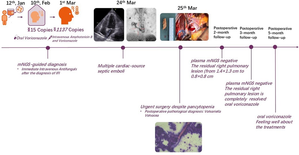 Timeline graphic of a medical case showing treatment progression from January to March. Key events include mNGS-guided diagnosis and treatment with antifungals, multiple cardiac-source septic emboli detection, and urgent surgery. Follow-ups at two, three, and five months show postoperative status and residual pulmonary lesion resolution. Images depict medical scans, surgical procedures, and pathological findings.