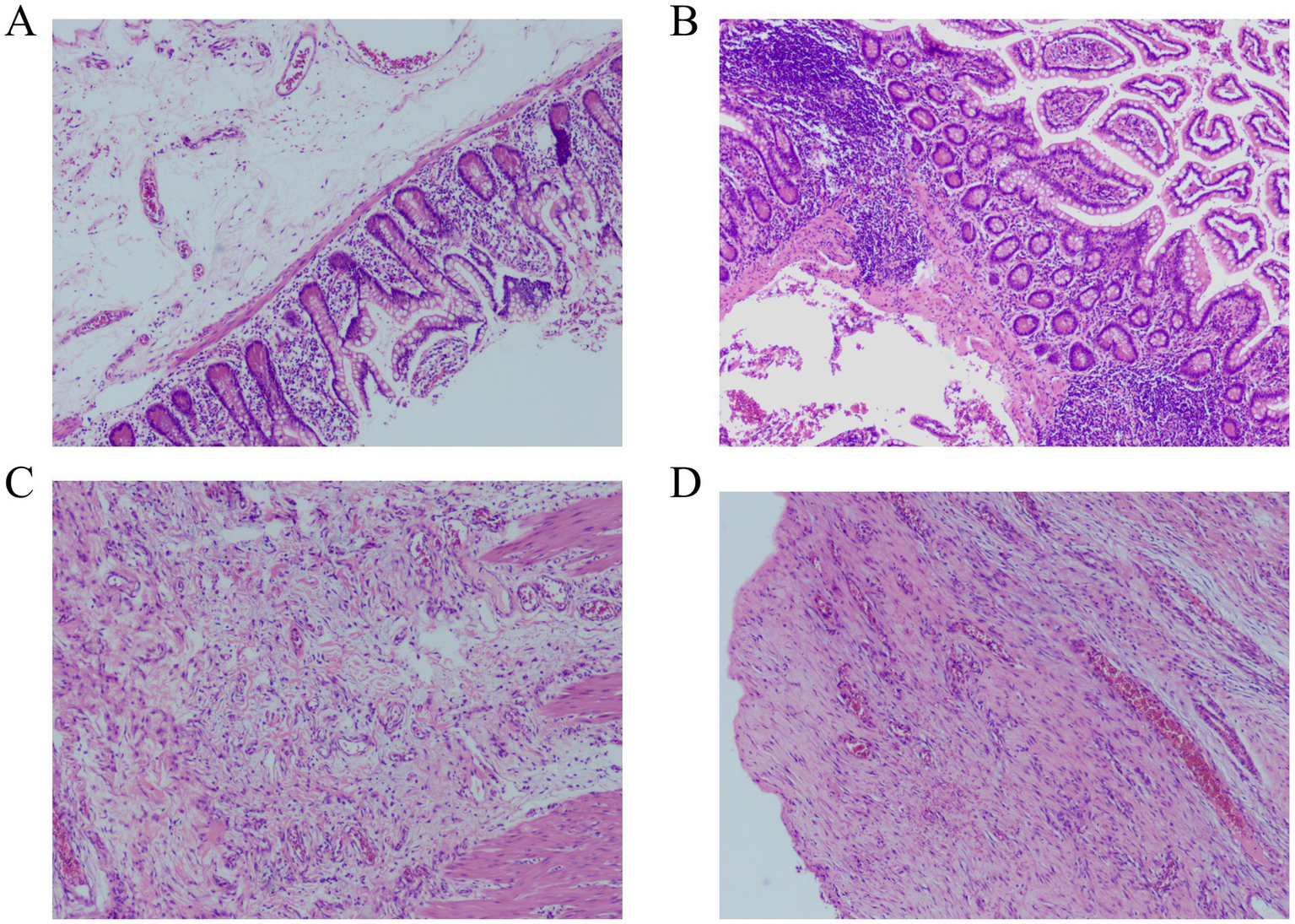 Histological images labeled A to D. Images A to D show numerous dilated and engorged blood vessels within the submucosa and serosa layers of the intestine. All images are stained to highlight cellular and structural details.