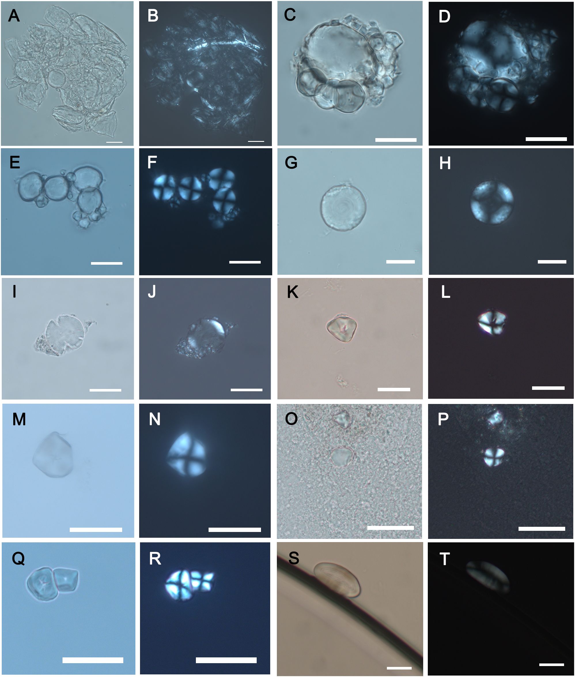Microscopic images of starch grains arranged in a grid from A to T. Each panel shows different morphotypes under varying lighting conditions, such as brightfield and fluorescence. The scale bars indicate magnification levels.