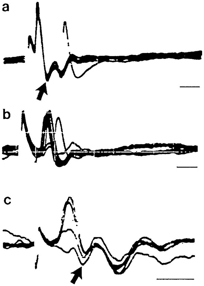 Three graphs labeled a, b, and c show different waveform patterns with distinct peaks and troughs. Arrows highlight specific areas of interest in each graph. The waveforms differ in amplitude and complexity, with each presenting a unique pattern. Lines at the right indicate scale.