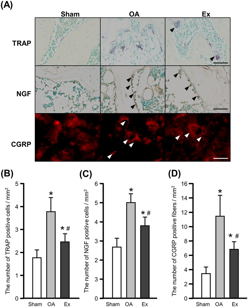 Panel A shows histological sections for TRAP, NGF, and CGRP across Sham, OA, and Ex conditions. TRAP shows staining differences, with more marked expression in OA and Ex. NGF displays increased positive cells in OA and Ex, indicated by arrowheads. CGRP shows more positive fibers under OA and Ex. Panels B, C, and D present bar graphs quantifying TRAP, NGF, and CGRP positive cells or fibers per square millimeter, with higher values observed in OA compared to Sham, and Ex showing varied results. Statistical significance is marked by asterisks and hash signs.